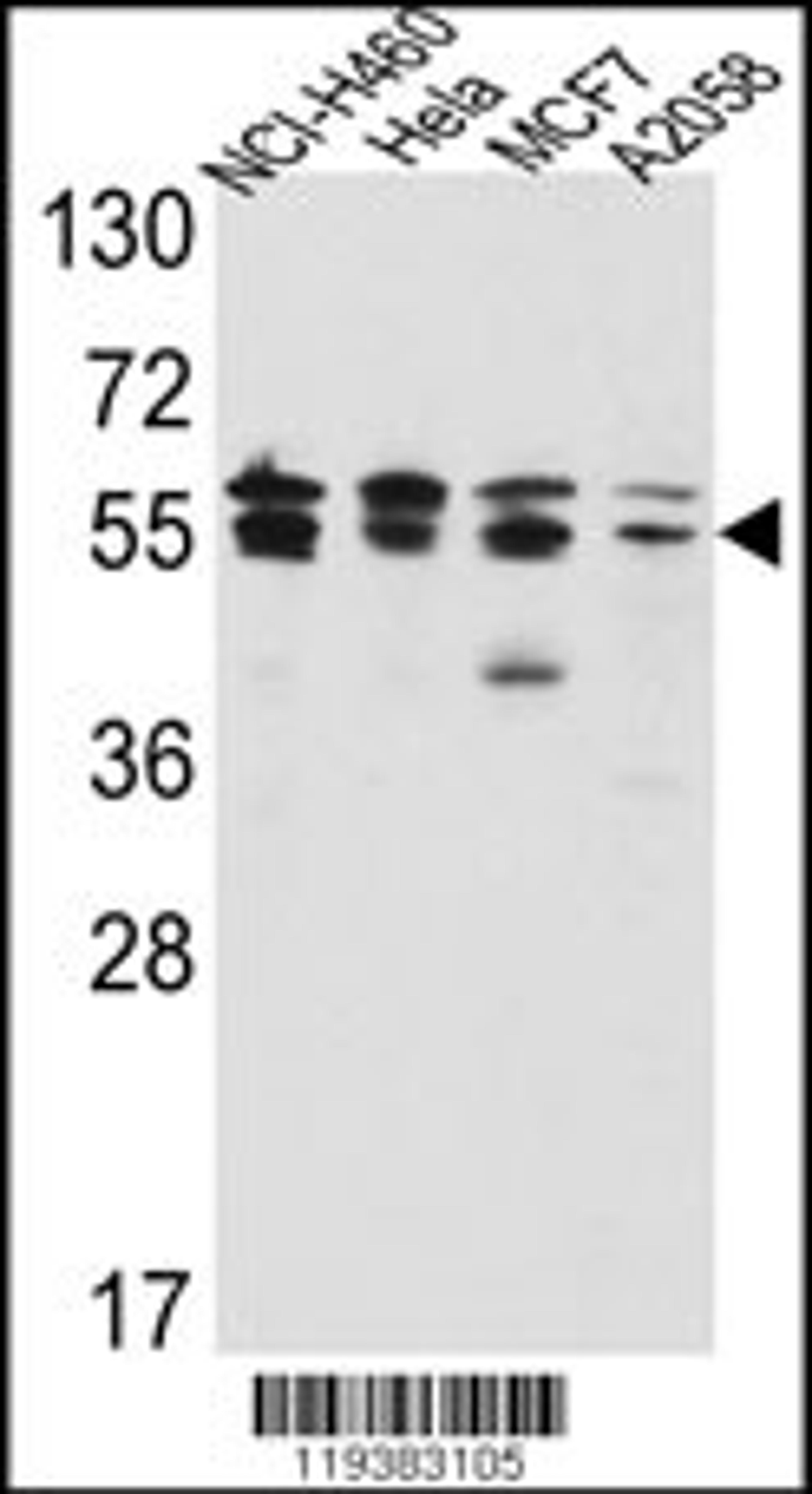 Western blot analysis of IMPDH2 Antibody in NCI-H460,Hela,MCF7,A2058 cell line lysates(35ug/lane)