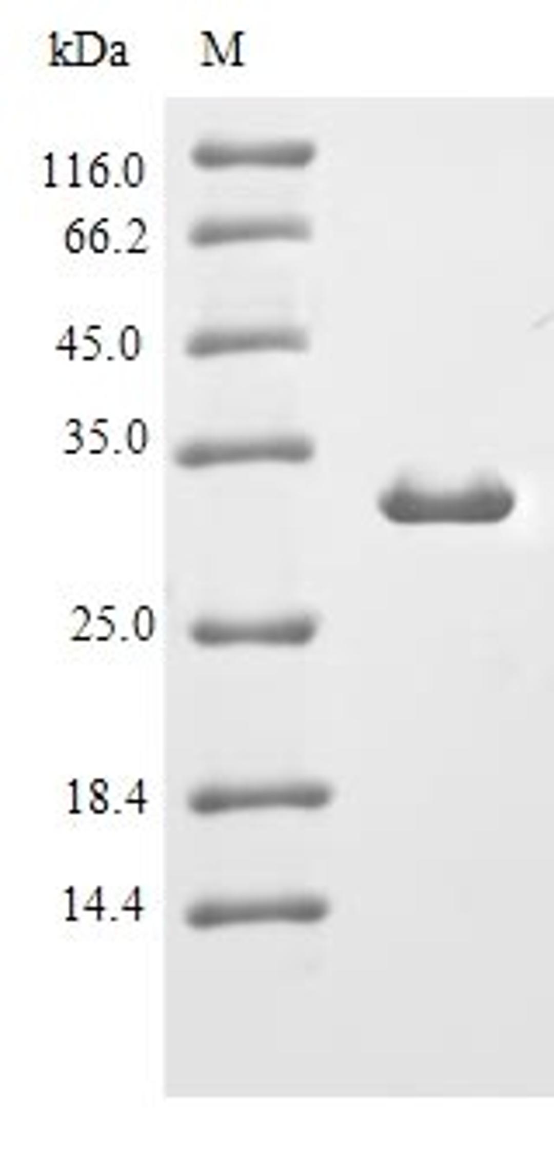 (Tris-Glycine gel) Discontinuous SDS-PAGE (reduced) with 5% enrichment gel and 15% separation gel.