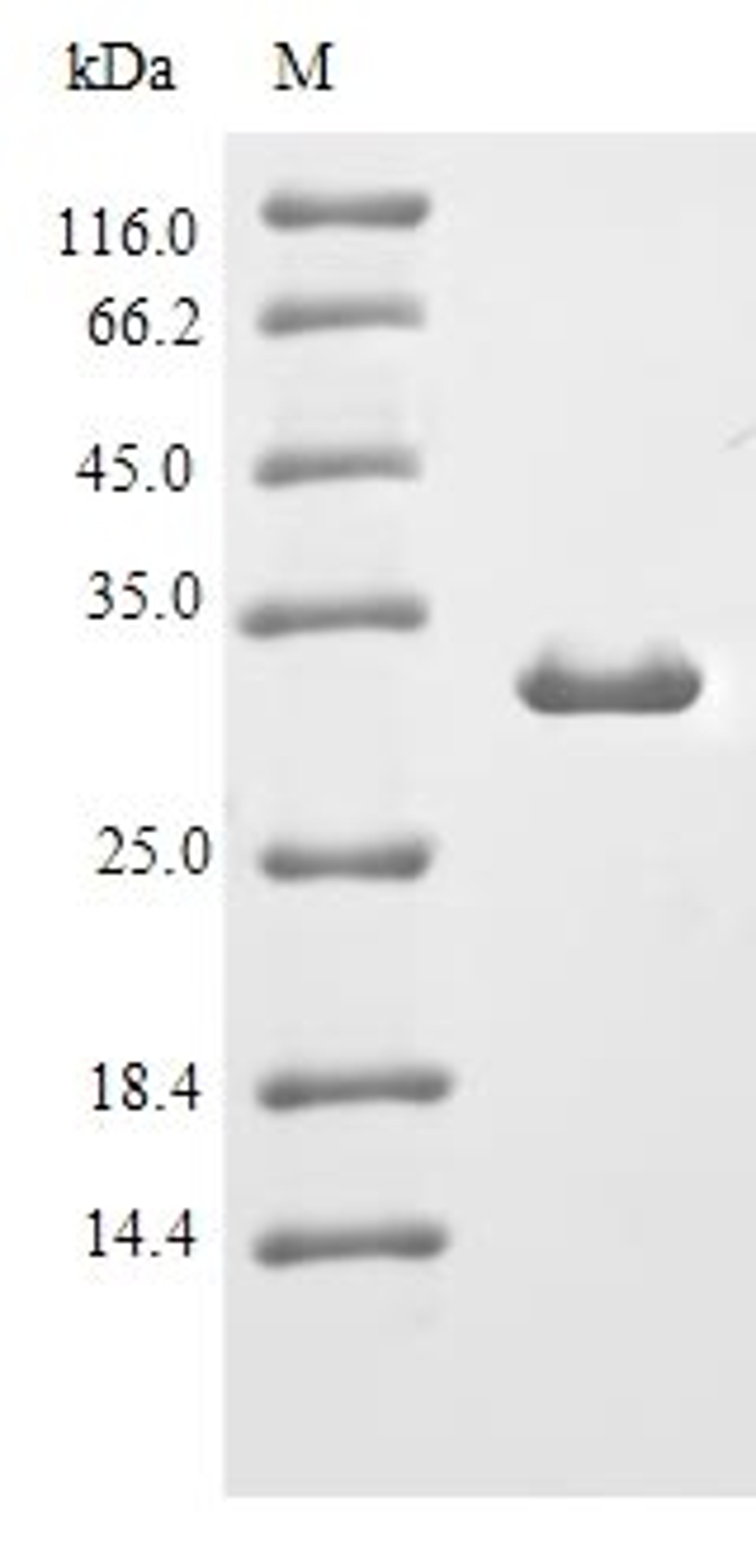 (Tris-Glycine gel) Discontinuous SDS-PAGE (reduced) with 5% enrichment gel and 15% separation gel.