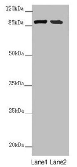 Western blot. All lanes: CEP95 antibody at 6.06 ug/ml. Lane 1: Mouse heart tissue. Lane 2: Mouse kidney tissue. Secondary. Goat polyclonal to rabbit IgG at 1/10000 dilution. Predicted band size: 96, 77 kDa. Observed band size: 96 kDa. 