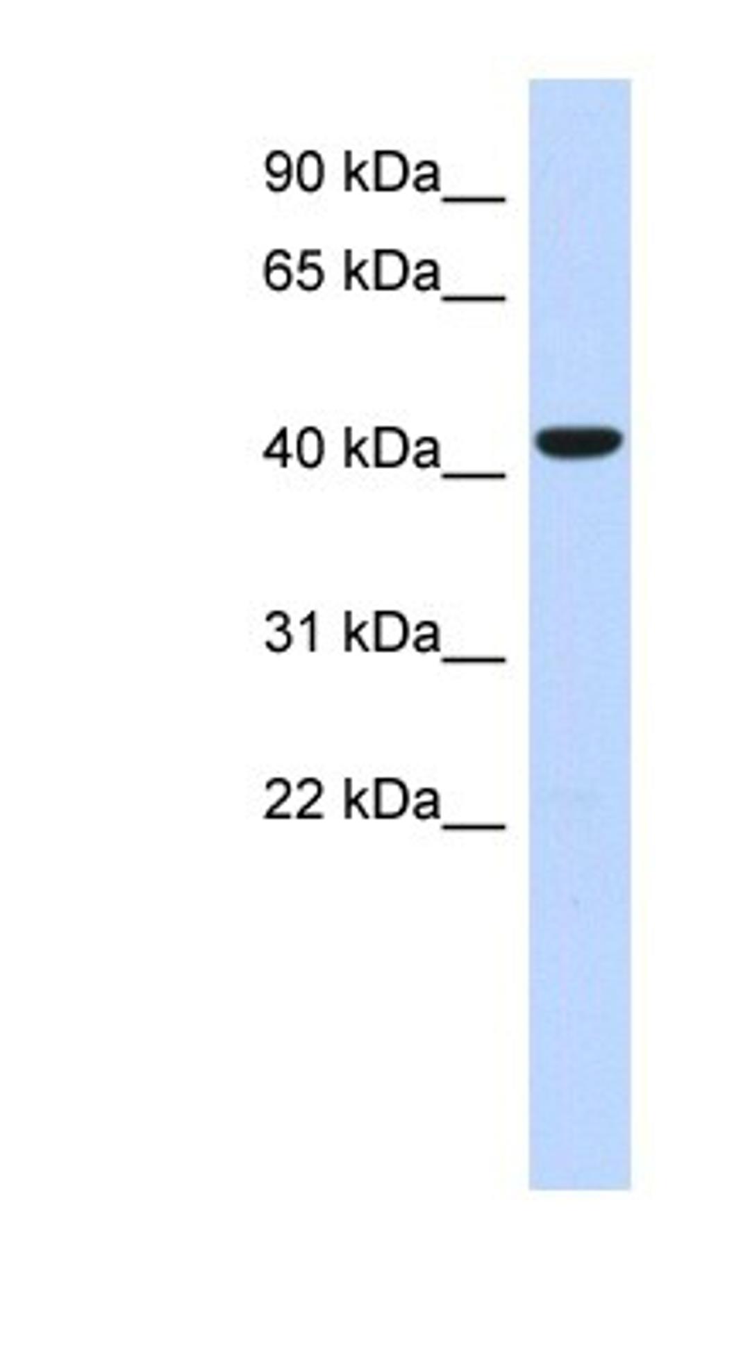 Western Blot: Sphingomyelin Synthase 2 Antibody [NBP1-60004] - Titration: 0.2-1 ug/ml, Positive Control: Human heart.