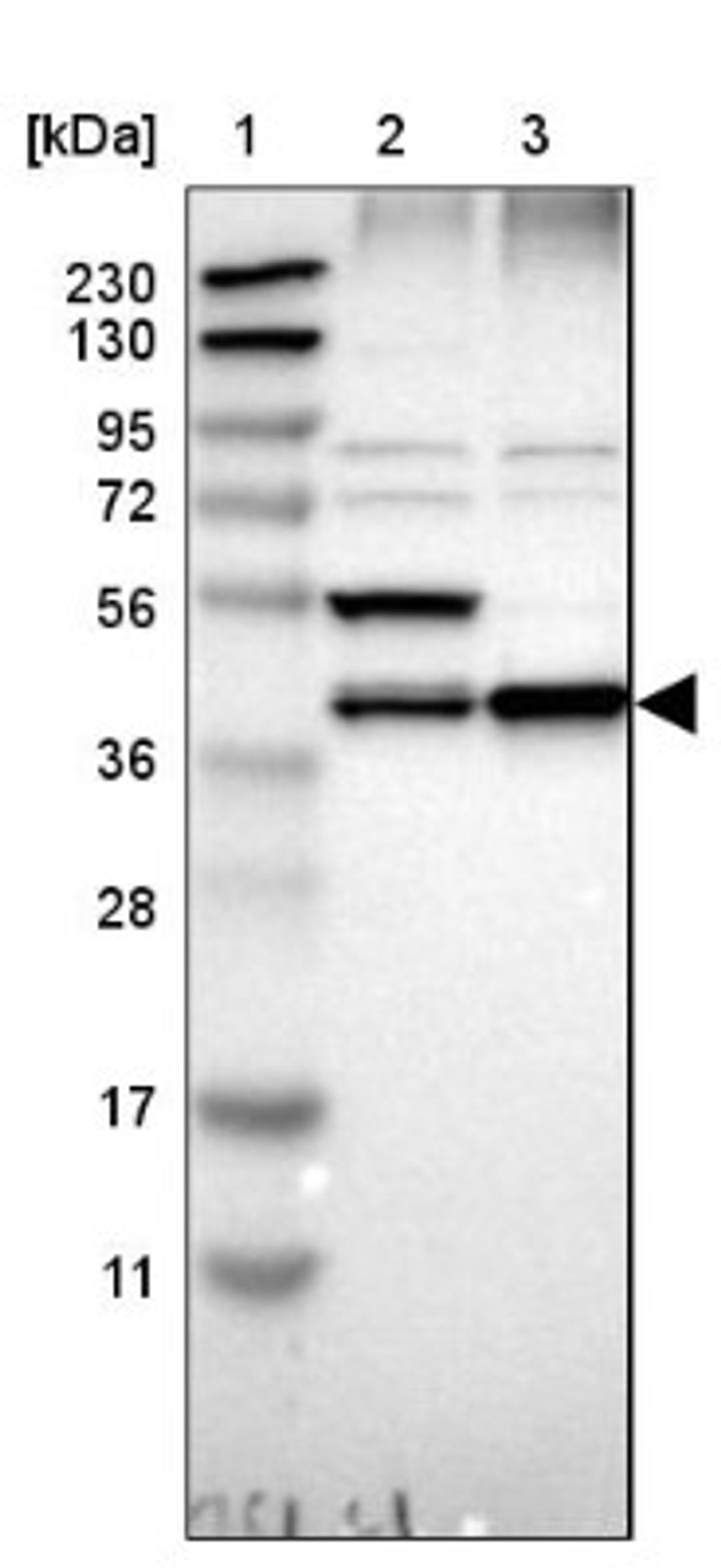 Western Blot: ERLIN1 Antibody [NBP1-88539] - Lane 1: Marker [kDa] 230, 130, 95, 72, 56, 36, 28, 17, 11<br/>Lane 2: Human cell line RT-4<br/>Lane 3: Human cell line U-251MG sp