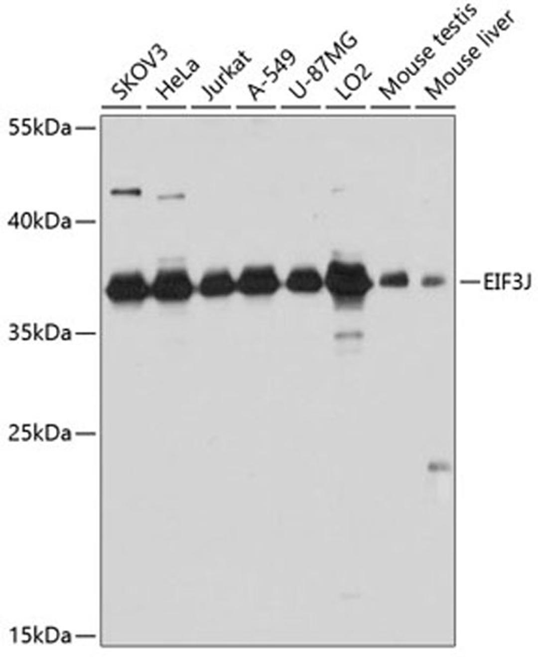 Western blot - EIF3J antibody (A8637)