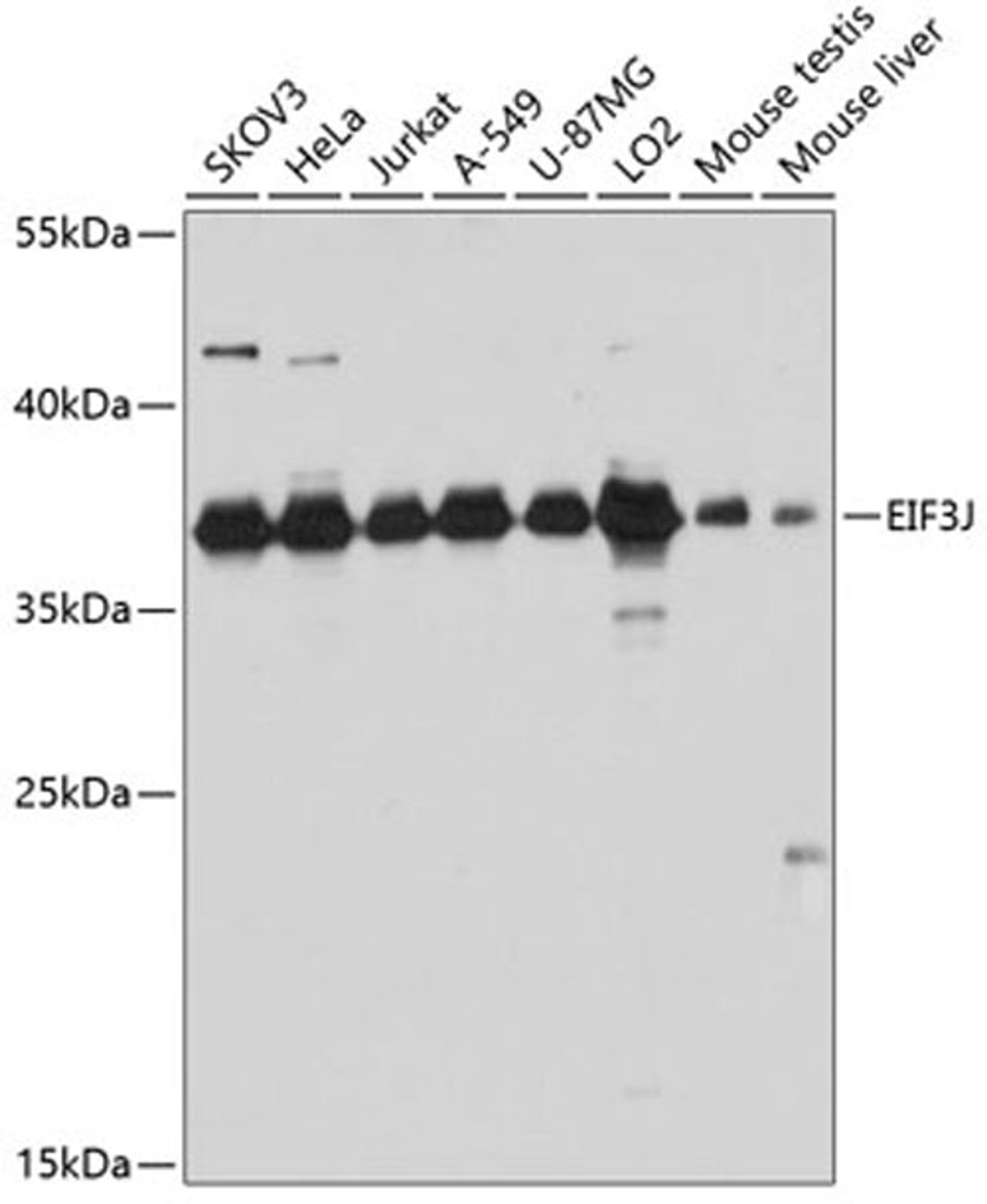 Western blot - EIF3J antibody (A8637)