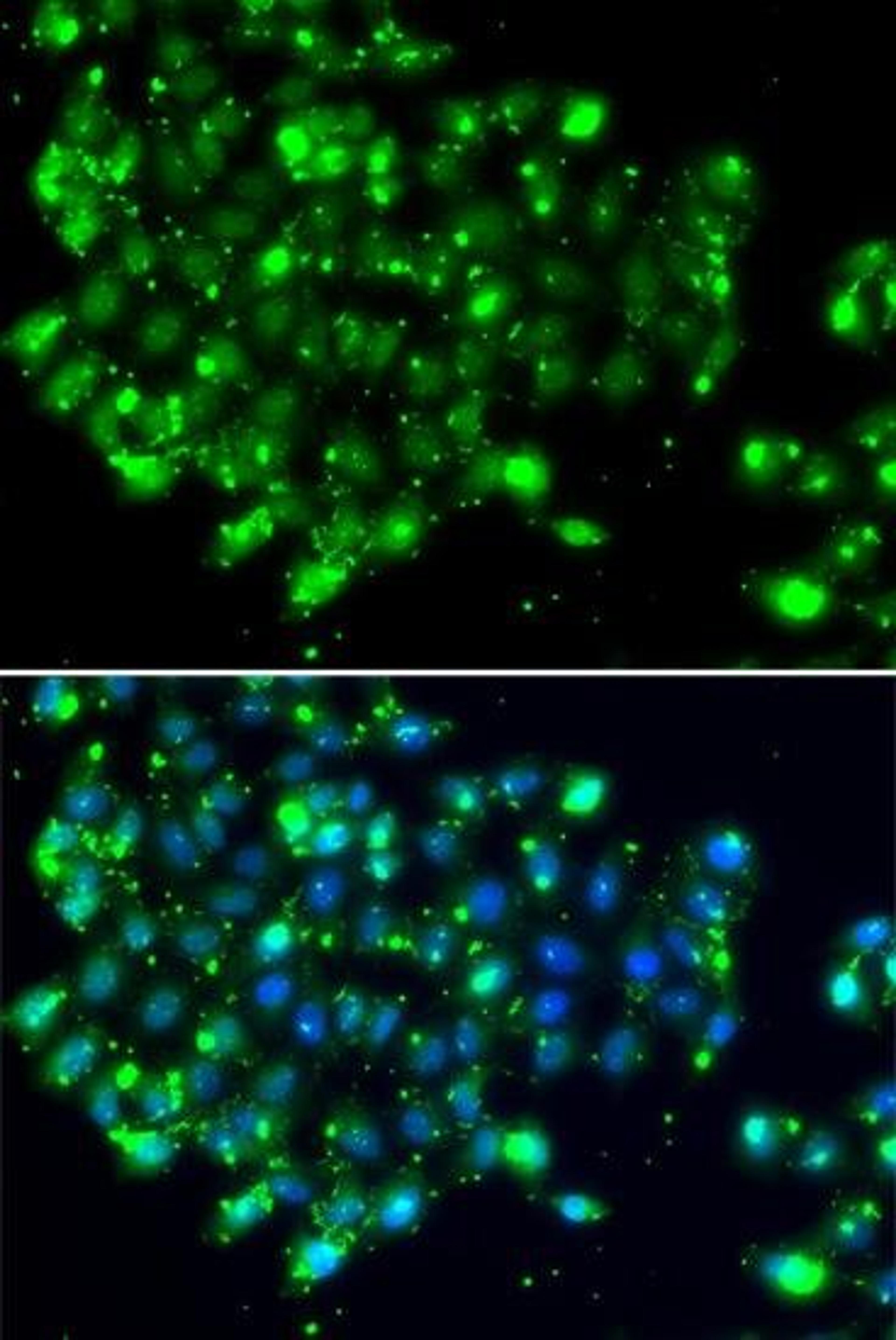 Immunofluorescence analysis of MCF7 cell using NAT9 antibody