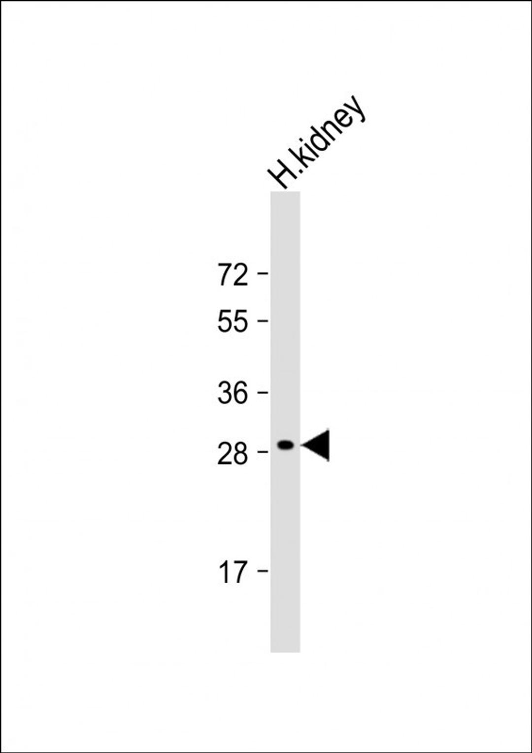 Western Blot at 1:2000 dilution + human kidney whole cell lysate Lysates/proteins at 20 ug per lane.