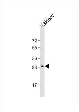 Western Blot at 1:2000 dilution + human kidney whole cell lysate Lysates/proteins at 20 ug per lane.