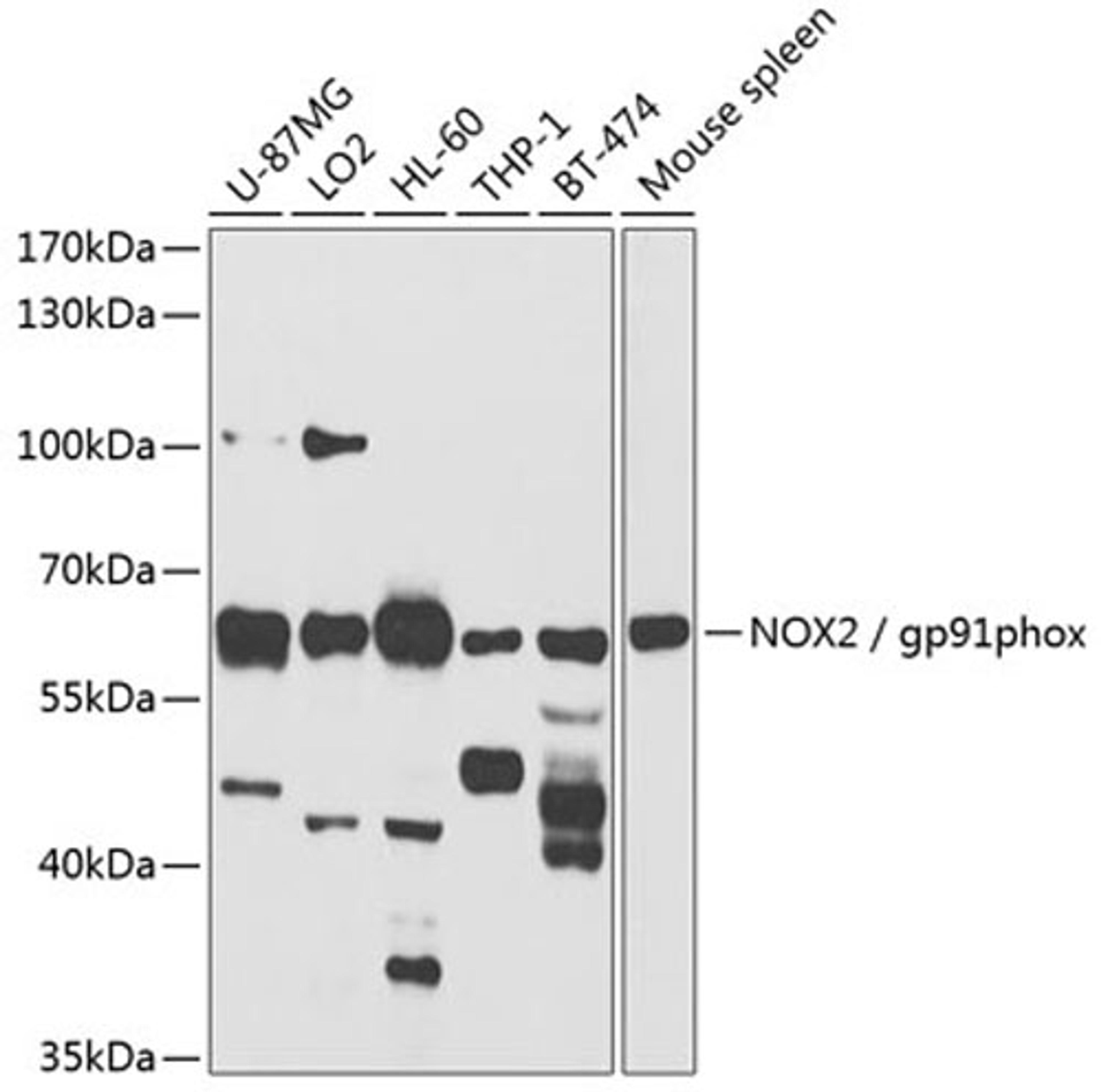 Western blot - NOX2 / gp91phox antibody (A1636)