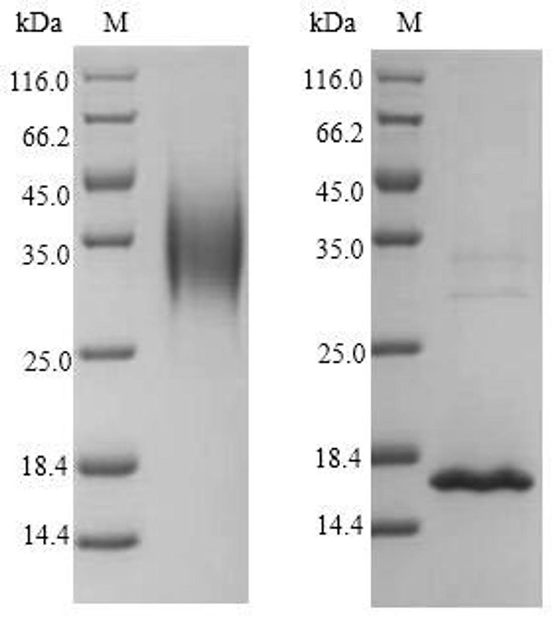 (Tris-Glycine gel) Discontinuous SDS-PAGE (reduced) with 5% enrichment gel and 15% separation gel.