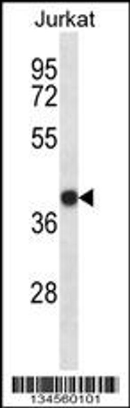 Western blot analysis in Jurkat cell line lysates (35ug/lane).