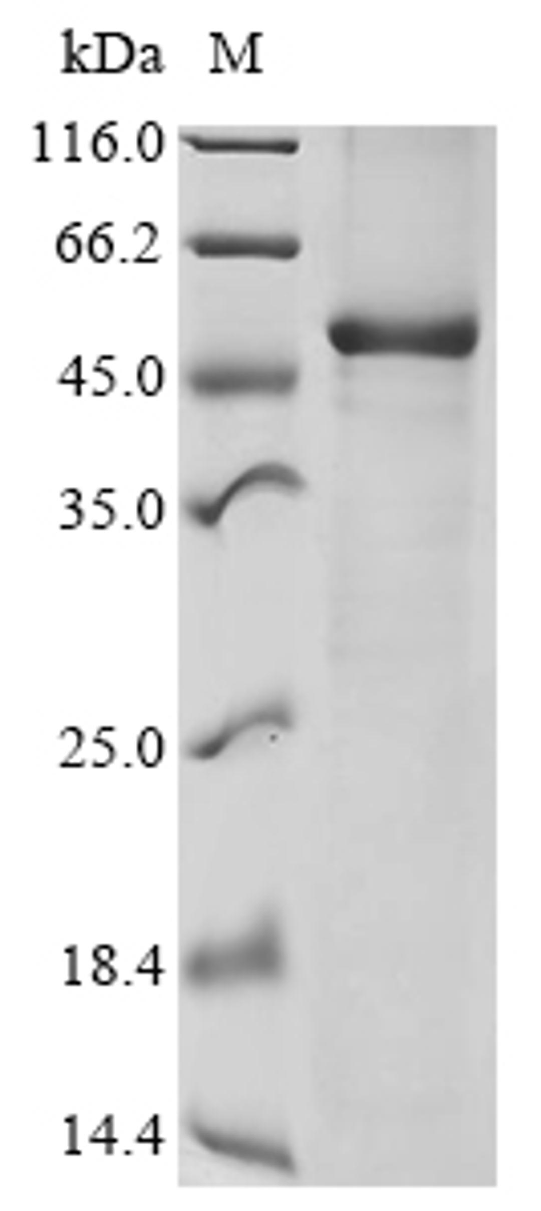 (Tris-Glycine gel) Discontinuous SDS-PAGE (reduced) with 5% enrichment gel and 15% separation gel.