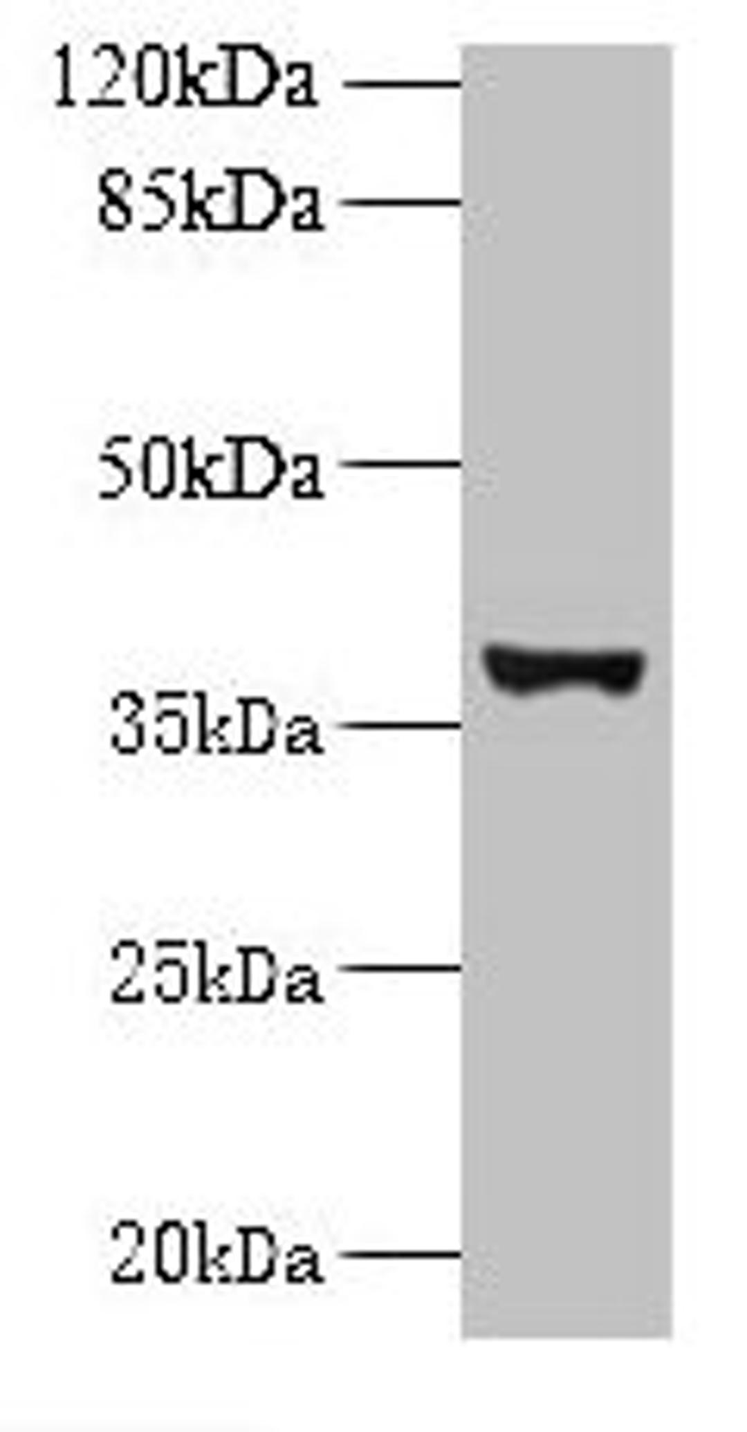 Western blot. All lanes: UBLCP1 antibody at 0.2µg/ml + U251 whole cell lysate. Secondary. Goat polyclonal to rabbit IgG at 1/10000 dilution. Predicted band size: 37 kDa. Observed band size: 37 kDa