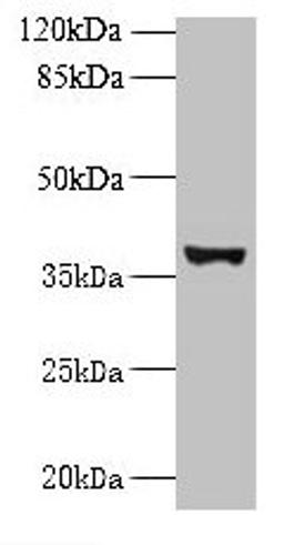 Western blot. All lanes: UBLCP1 antibody at 0.2µg/ml + U251 whole cell lysate. Secondary. Goat polyclonal to rabbit IgG at 1/10000 dilution. Predicted band size: 37 kDa. Observed band size: 37 kDa