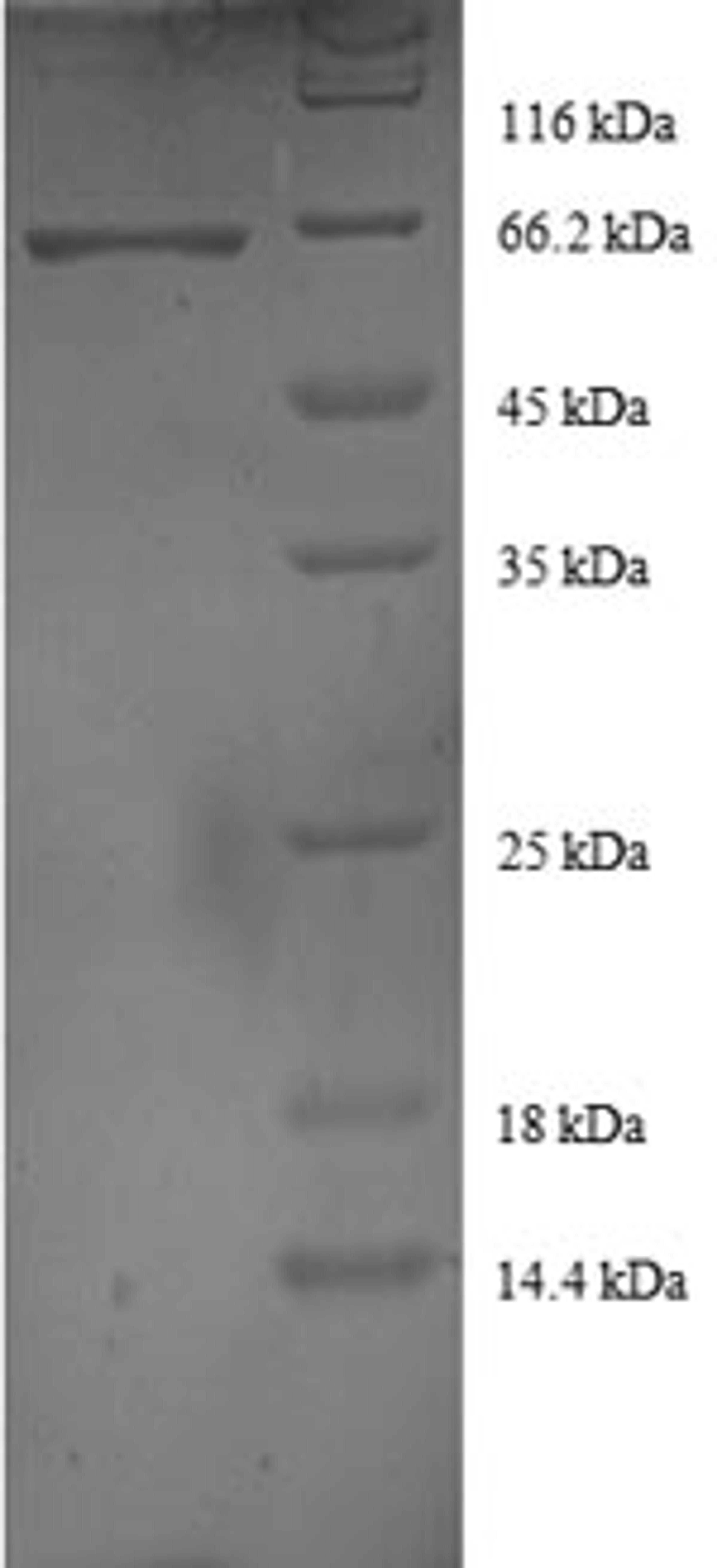 (Tris-Glycine gel) Discontinuous SDS-PAGE (reduced) with 5% enrichment gel and 15% separation gel.