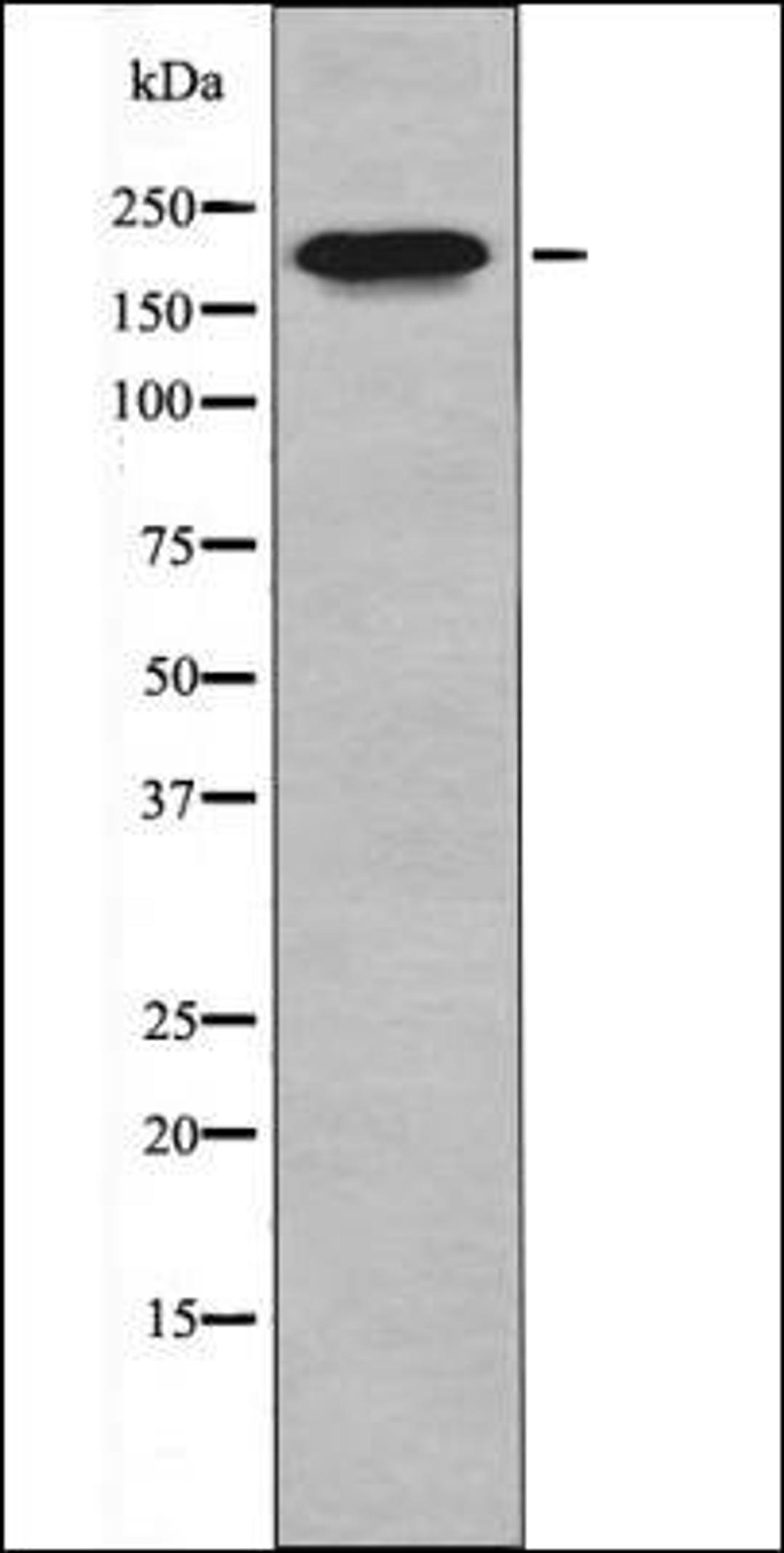 Western blot analysis of HepG2 whole cell lysates using MLC-2 -Phospho-Thr17+Ser18- antibody