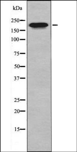 Western blot analysis of HepG2 whole cell lysates using MLC-2 -Phospho-Thr17+Ser18- antibody