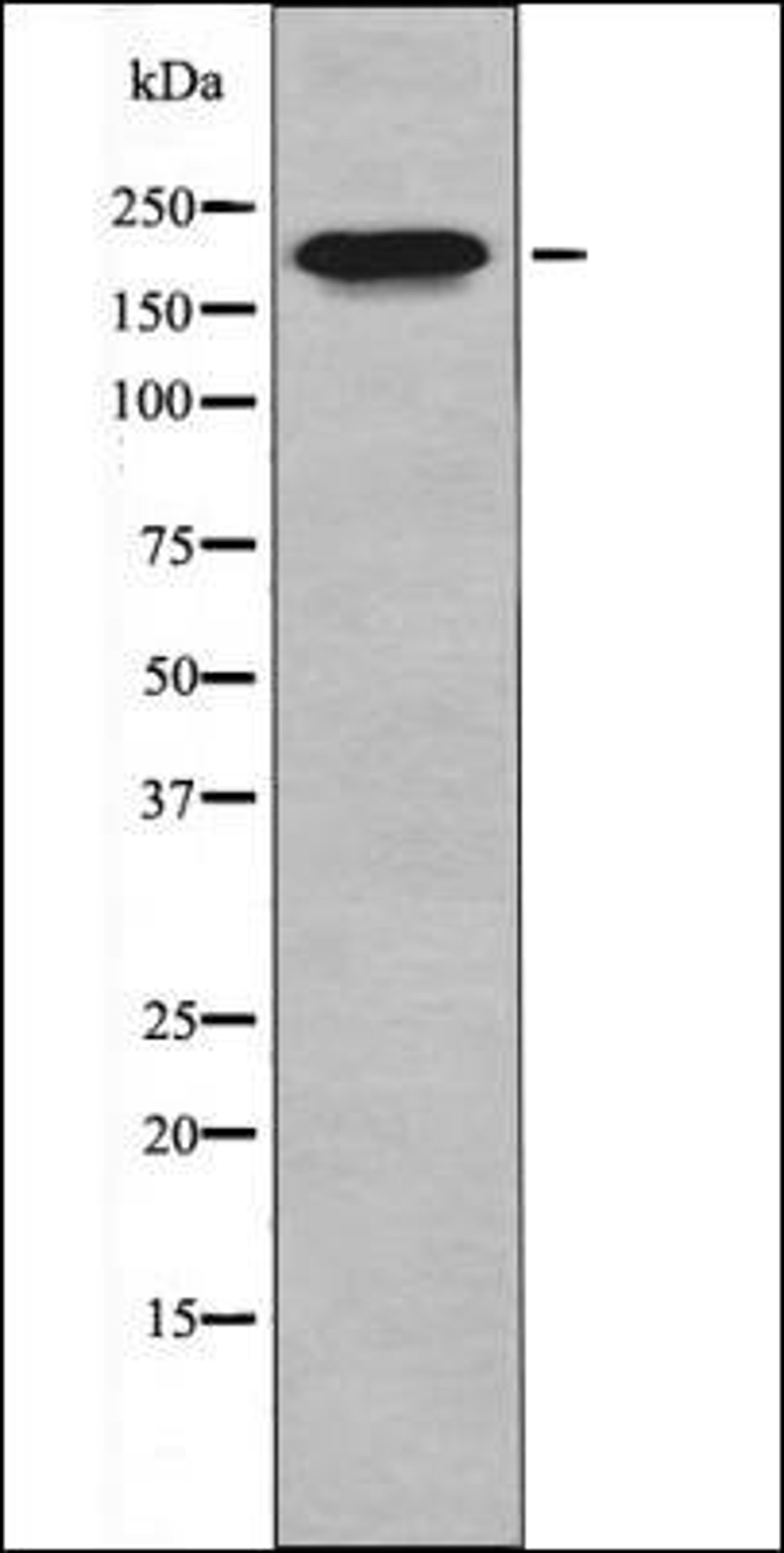 Western blot analysis of HepG2 whole cell lysates using MLC-2 -Phospho-Thr17+Ser18- antibody