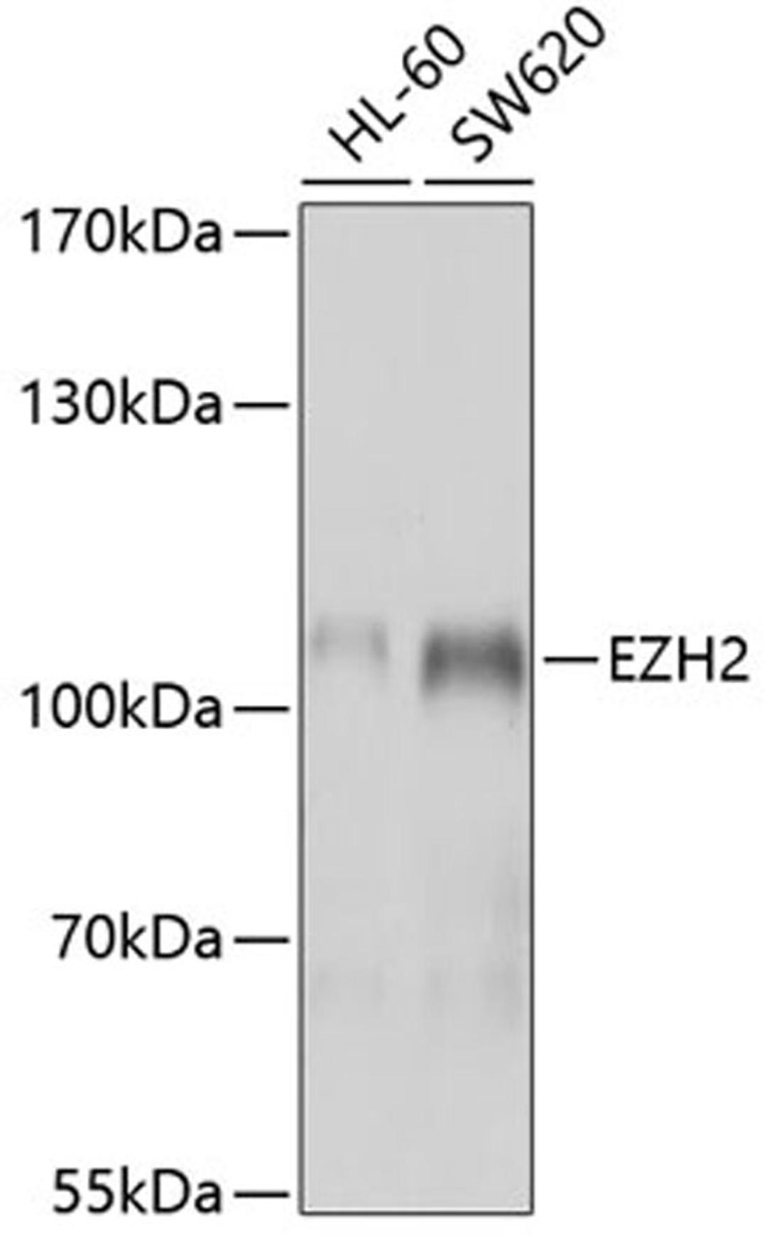 Western blot - EZH2 antibody (A5743)