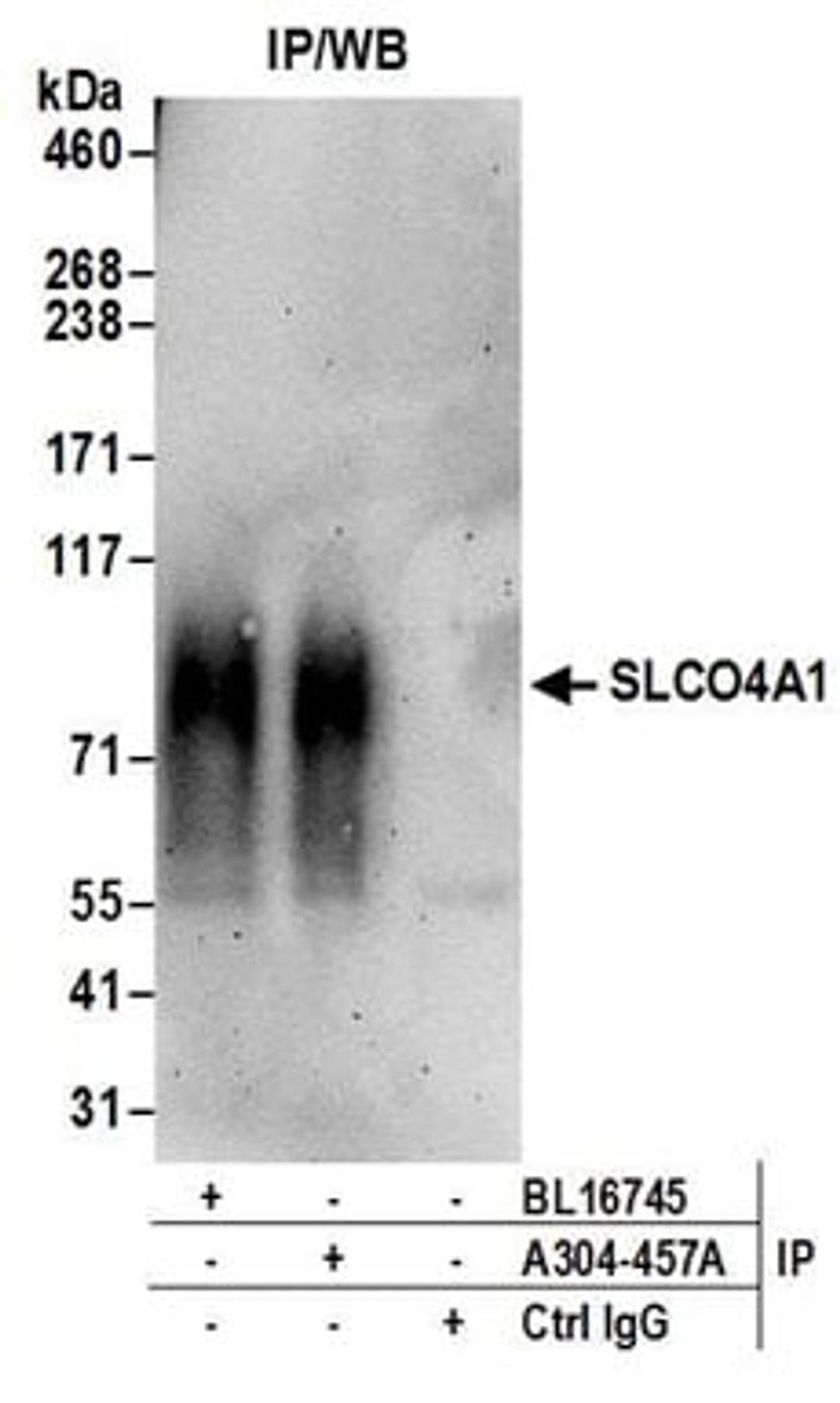 Detection of human SLCO4A1 by western blot of immunoprecipitates.