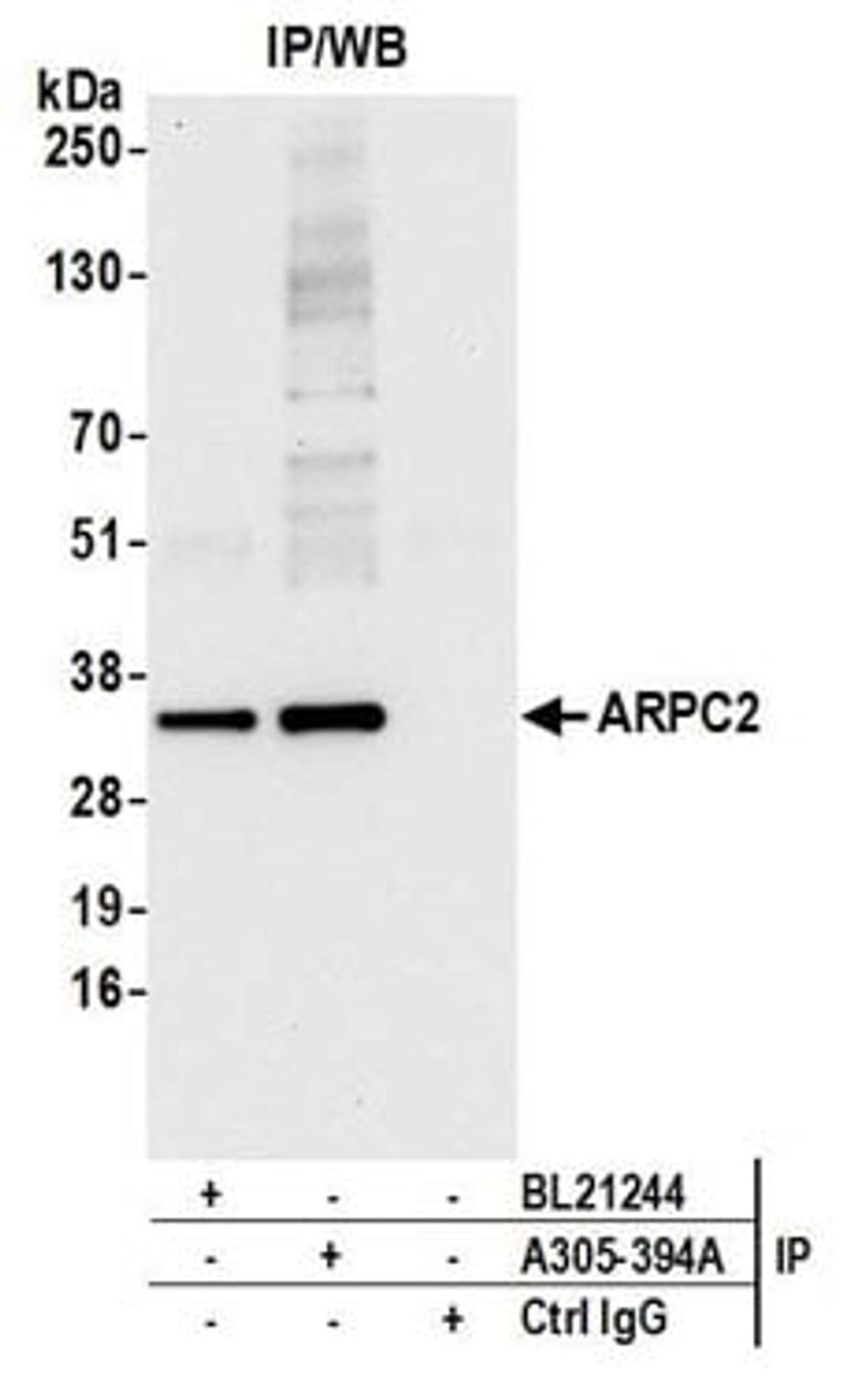 Detection of human ARPC2 by western blot of immunoprecipitates.