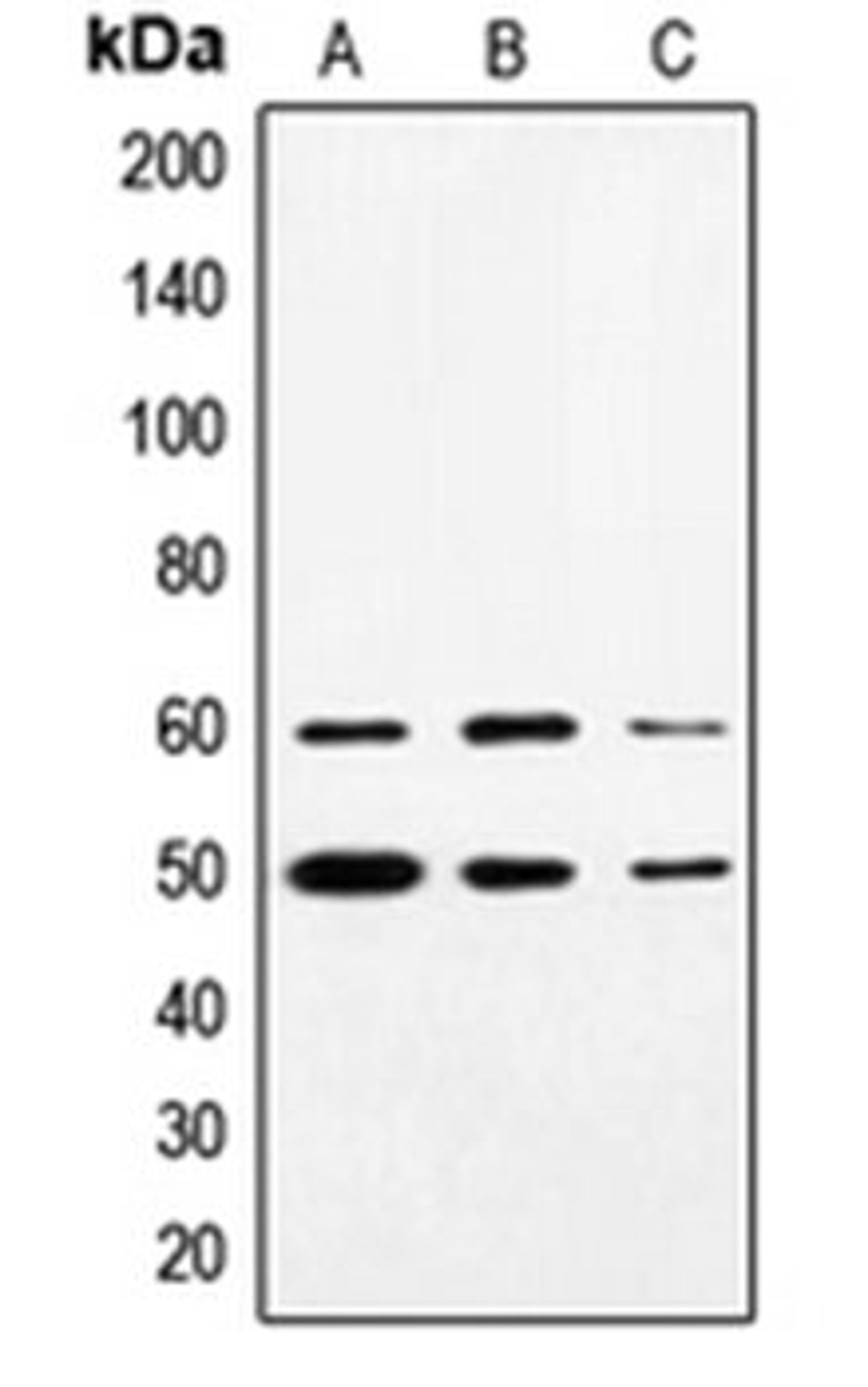 Western blot analysis of HeLa (Lane 1), Jurkat (Lane 2), A431 (Lane 3) whole cell lysates using SS18 antibody