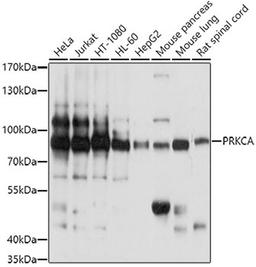 Western blot - PRKCA antibody (A13342)