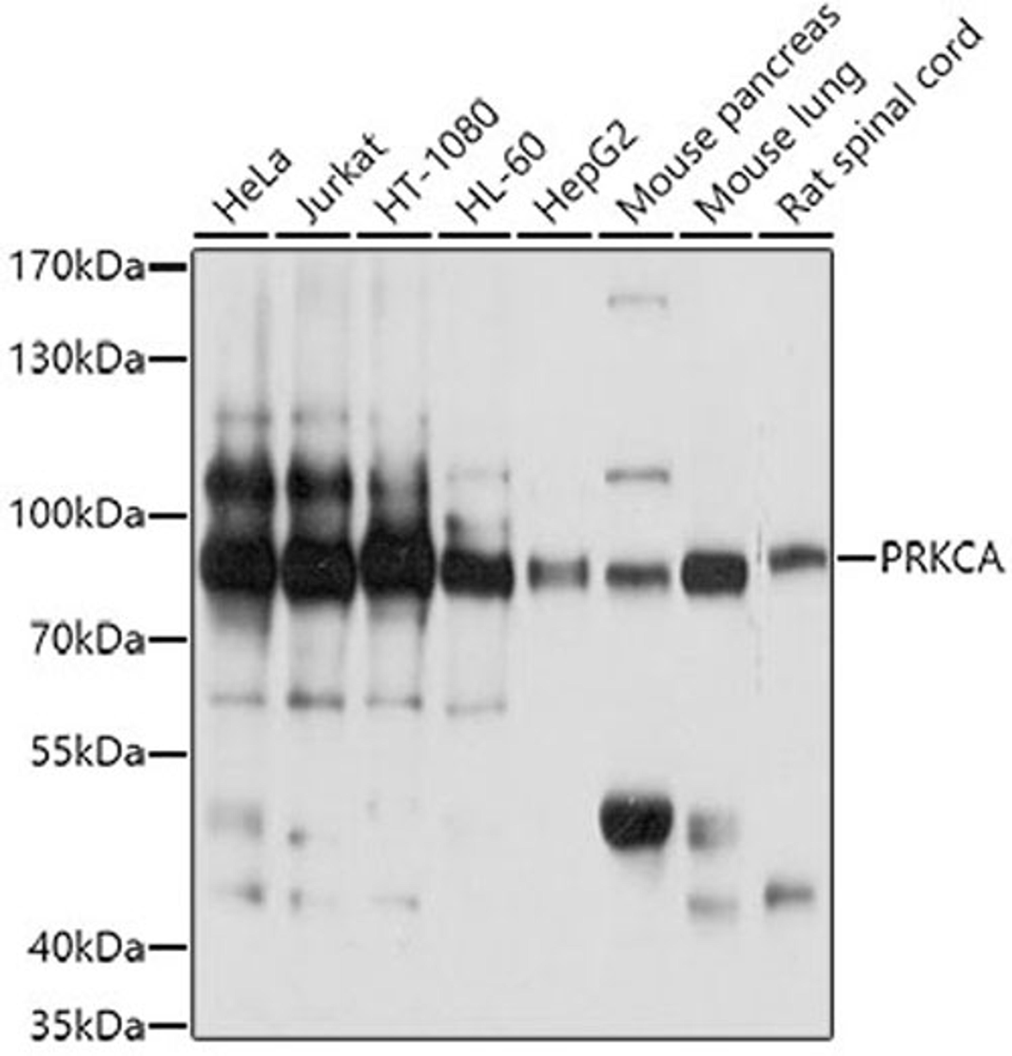 Western blot - PRKCA antibody (A13342)