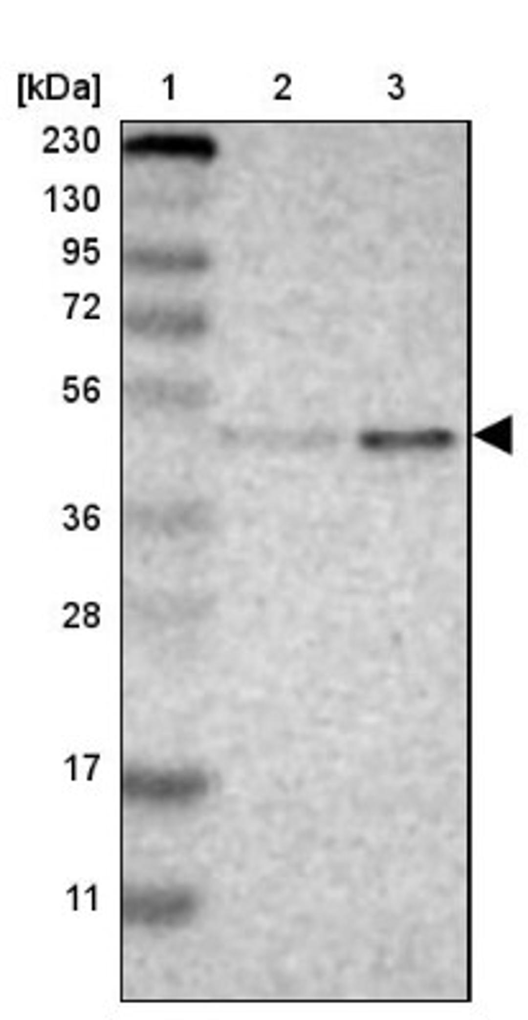 Western Blot: GALK1 Antibody [NBP1-81853] - Lane 1: Marker [kDa] 230, 130, 95, 72, 56, 36, 28, 17, 11<br/>Lane 2: Human cell line RT-4<br/>Lane 3: Human cell line U-251MG sp