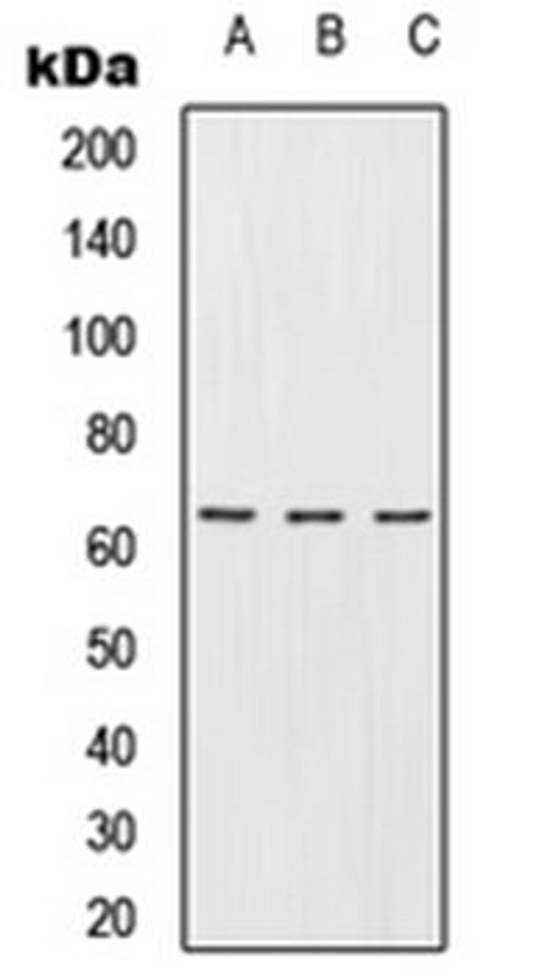 Western blot analysis of Jurkat (Lane 1), Raw264.7 (Lane 2), PC12 (Lane 3) whole cell lysates using URI1 antibody