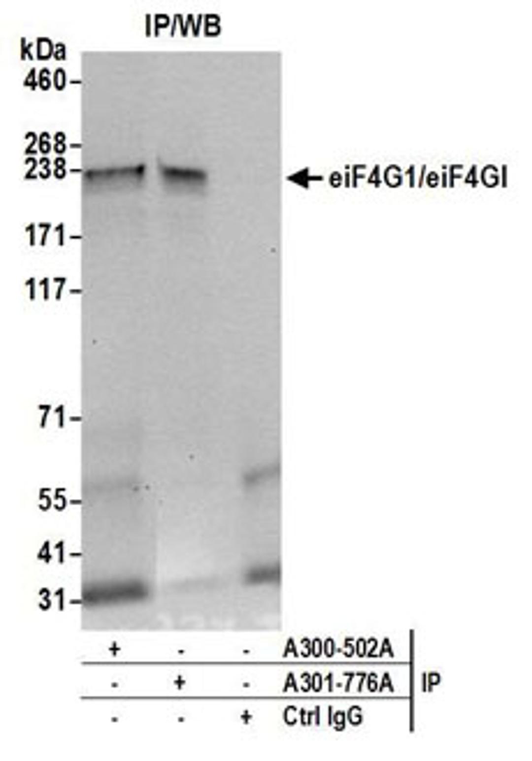 Detection of human eiF4G1/eiF4GI by western blot of immunoprecipitates.