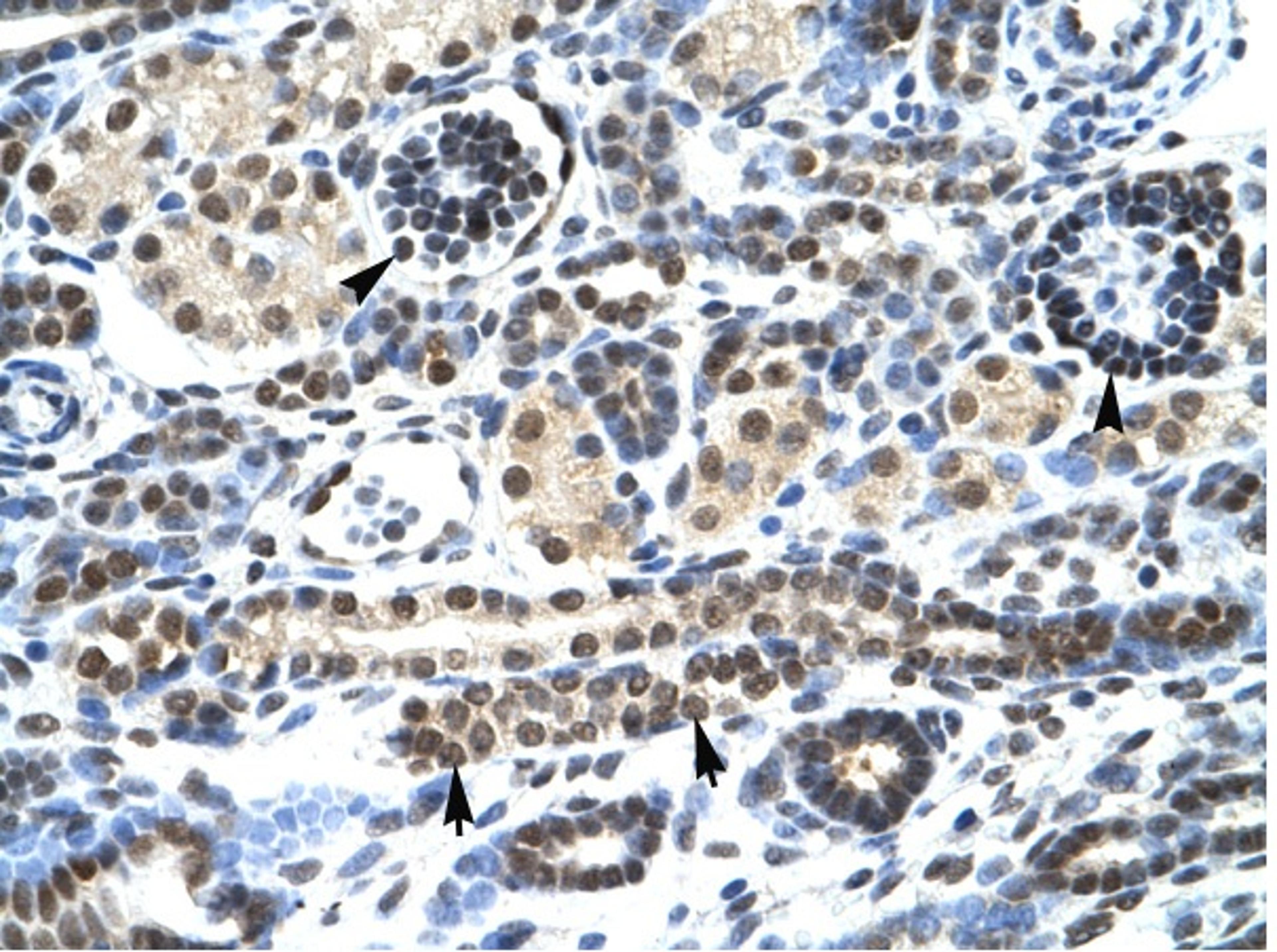 Antibody used in IHC on Human kidney.