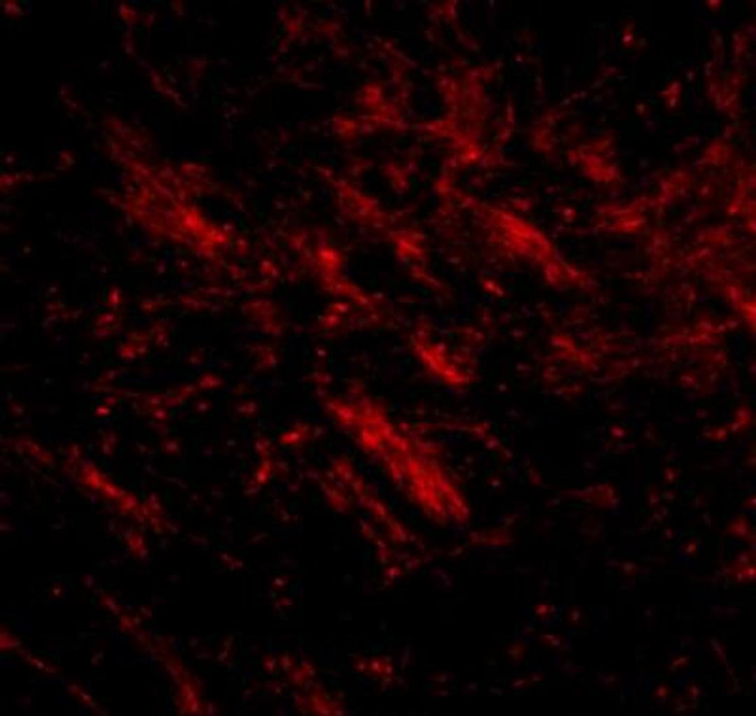 Immunocytochemistry/Immunofluorescence: CDIP Antibody [NBP1-76996] - Immunofluorescence of CDIP1 in mouse brain tissue with CDIP1 antibody at 20 ug/mL.