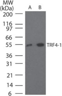 Western Blot: DNA polymerase sigma Antibody [NB100-56356] - Analysis of DNA polymerase sigma in HeLa cell lysate using NB100-56356 at A) 2 ug/ml and B) 5 ug/ml.