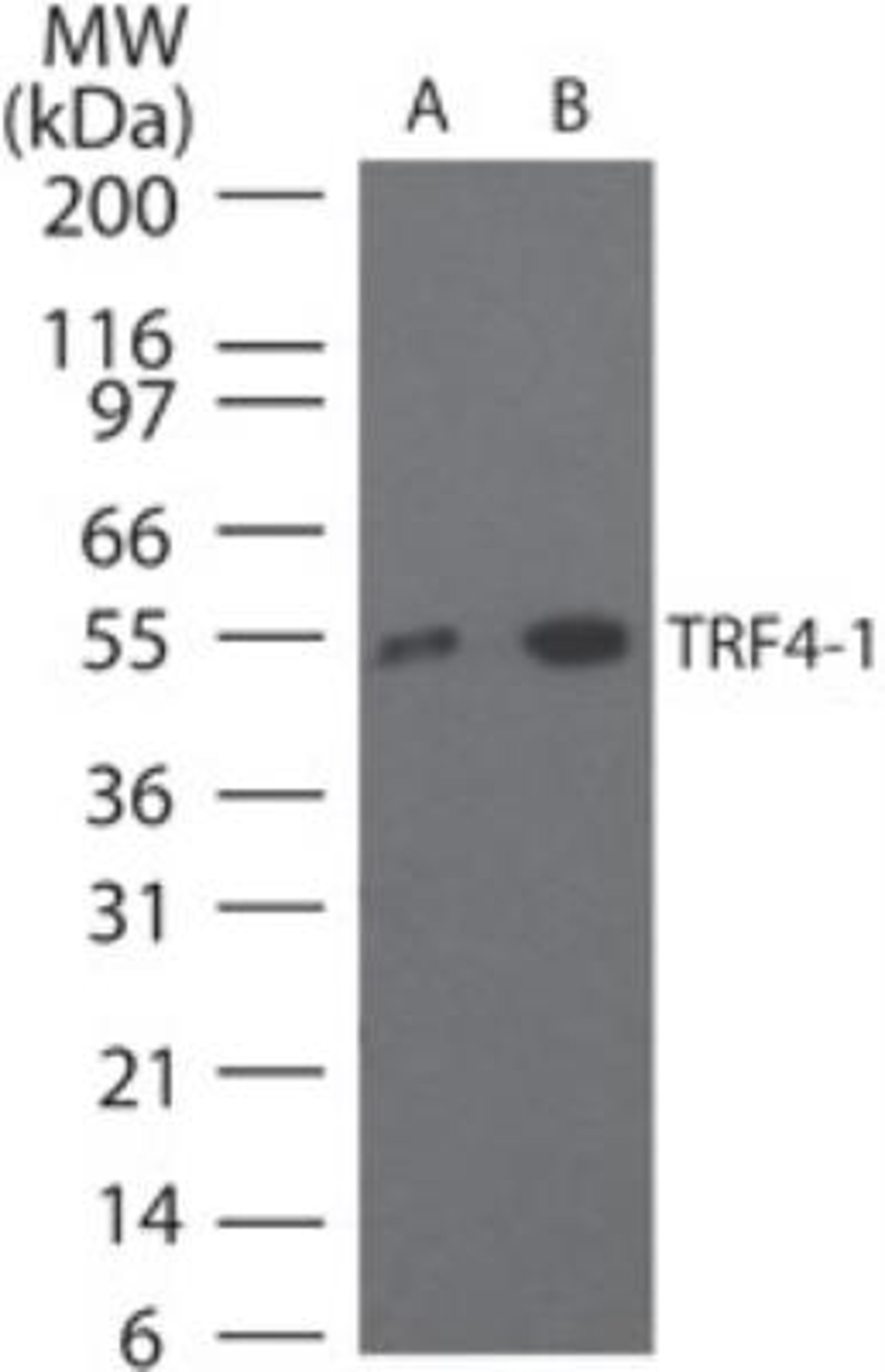 Western Blot: DNA polymerase sigma Antibody [NB100-56356] - Analysis of DNA polymerase sigma in HeLa cell lysate using NB100-56356 at A) 2 ug/ml and B) 5 ug/ml.