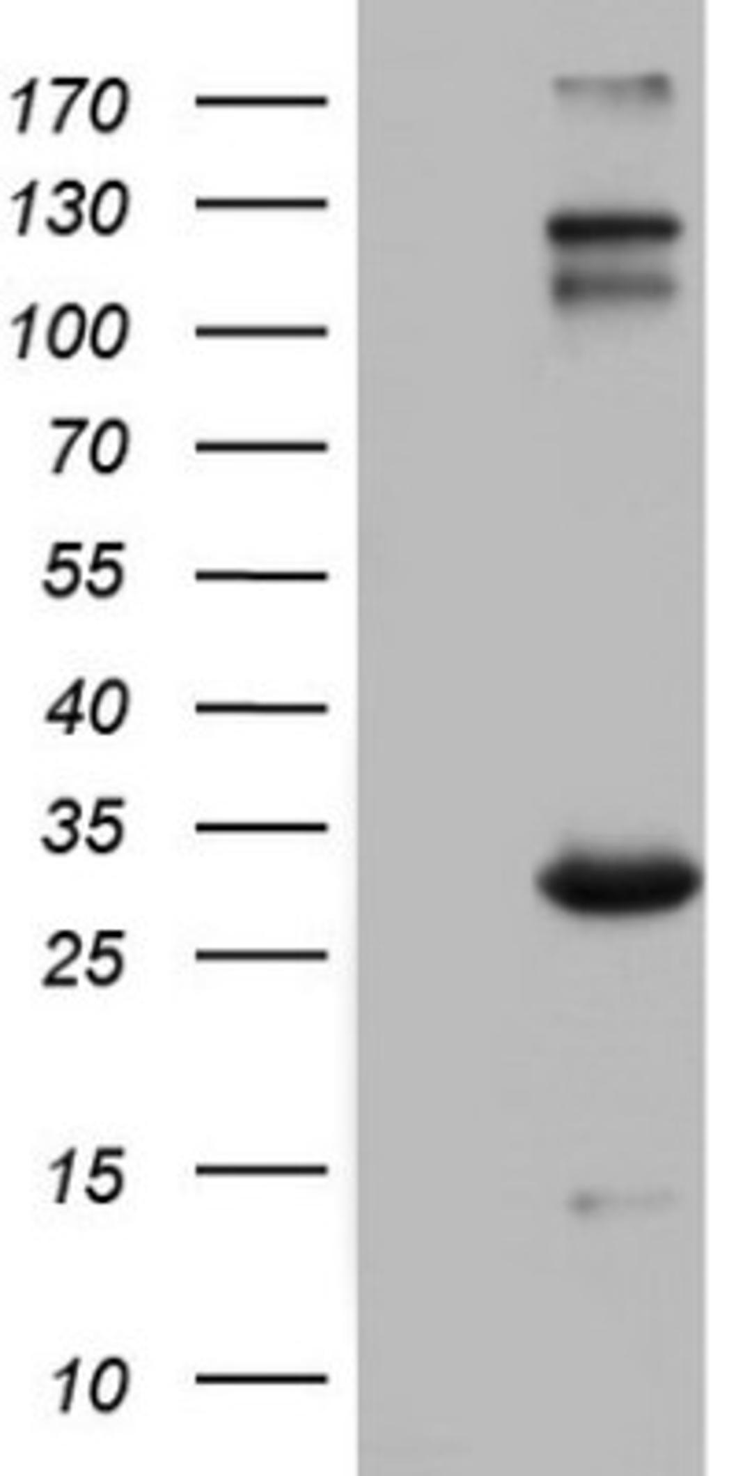 Western Blot: VSIG3/IGSF11 Antibody (2H1) [NBP2-46046] - Analysis of HEK293T cells were transfected with the pCMV6-ENTRY control (Left lane) or pCMV6-ENTRY IGSF11 .