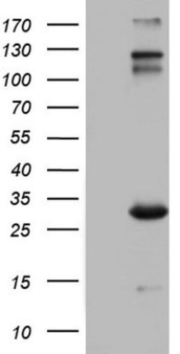 Western Blot: VSIG3/IGSF11 Antibody (2H1) [NBP2-46046] - Analysis of HEK293T cells were transfected with the pCMV6-ENTRY control (Left lane) or pCMV6-ENTRY IGSF11 .