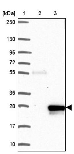 Western Blot: FAT10 Antibody [NBP2-13498] - Lane 1: Marker [kDa] 250, 130, 95, 72, 55, 36, 28, 17, 10<br/>Lane 2: Negative control (vector only transfected HEK293T lysate)<br/>Lane 3: Over-expression lysate (Co-expressed with a C-terminal myc-DDK tag (~3.1 kDa) in mammalian HEK293T cells, LY401929)