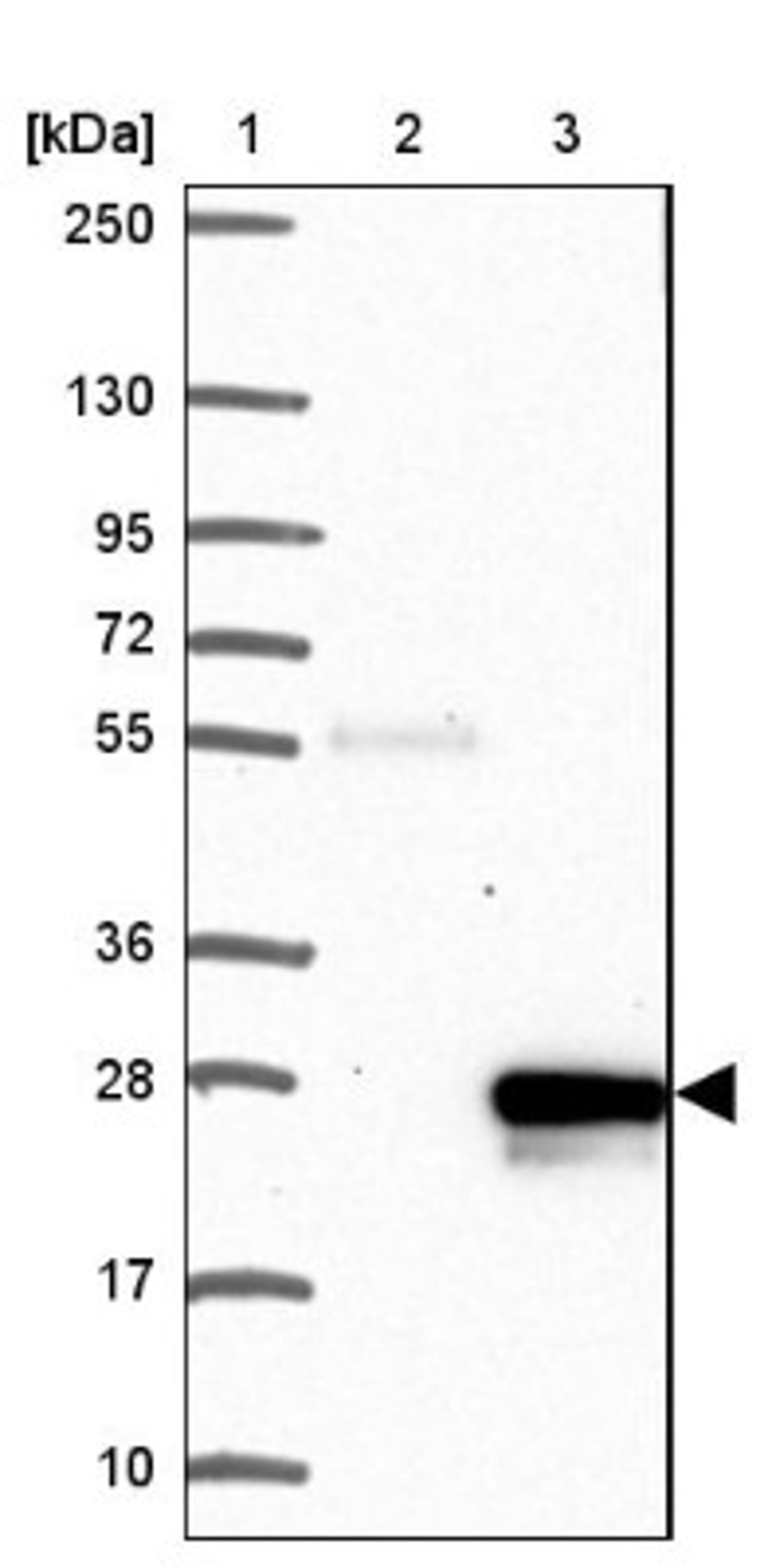 Western Blot: FAT10 Antibody [NBP2-13498] - Lane 1: Marker [kDa] 250, 130, 95, 72, 55, 36, 28, 17, 10<br/>Lane 2: Negative control (vector only transfected HEK293T lysate)<br/>Lane 3: Over-expression lysate (Co-expressed with a C-terminal myc-DDK tag (~3.1 kDa) in mammalian HEK293T cells, LY401929)