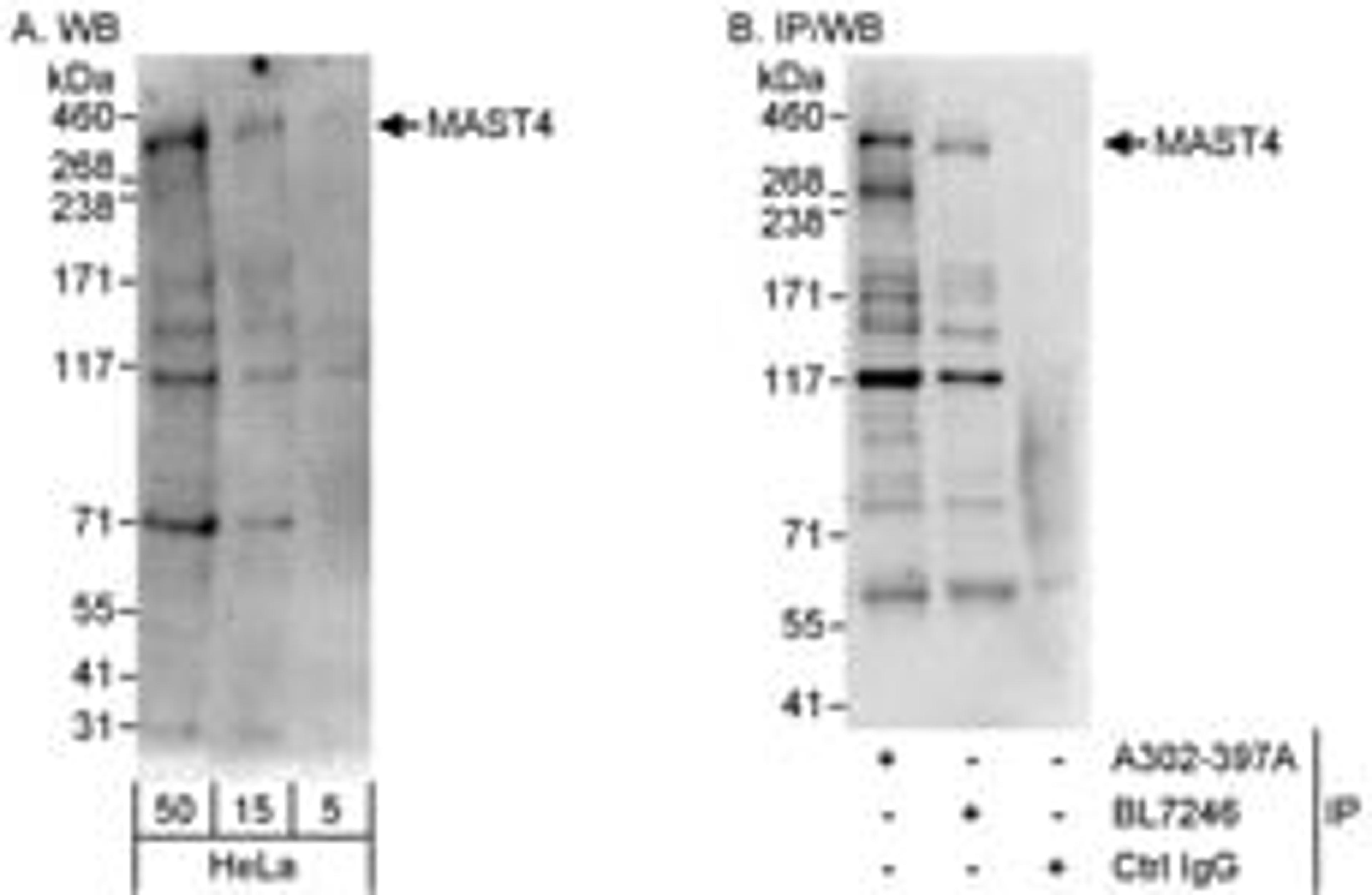 Detection of human MAST4 by western blot and immunoprecipitation.