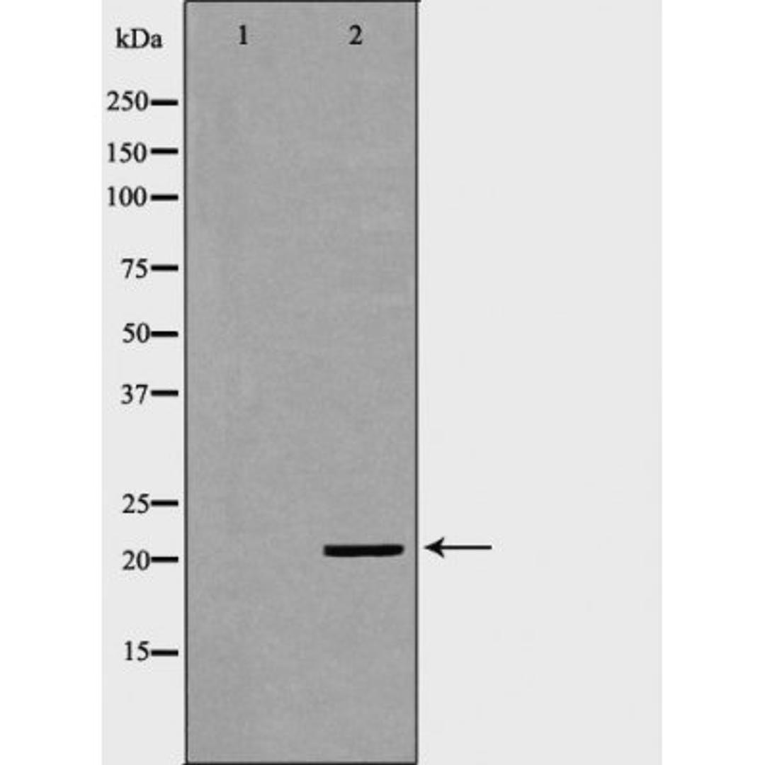 Western blot analysis of brain cell lysate using KRAS antibody