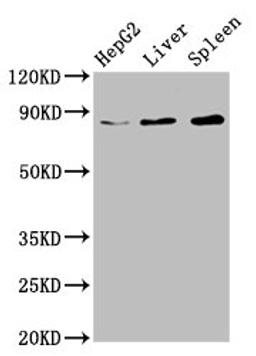 Western Blot. Positive WB detected in: HepG2 whole cell lysate, Rat liver tissue, Mouse spleen tissue. All lanes: NSUN2 antibody at 6.7ug/ml. Secondary. Goat polyclonal to rabbit IgG at 1/50000 dilution. Predicted band size: 87, 83, 60 kDa. Observed band size: 87 kDa.