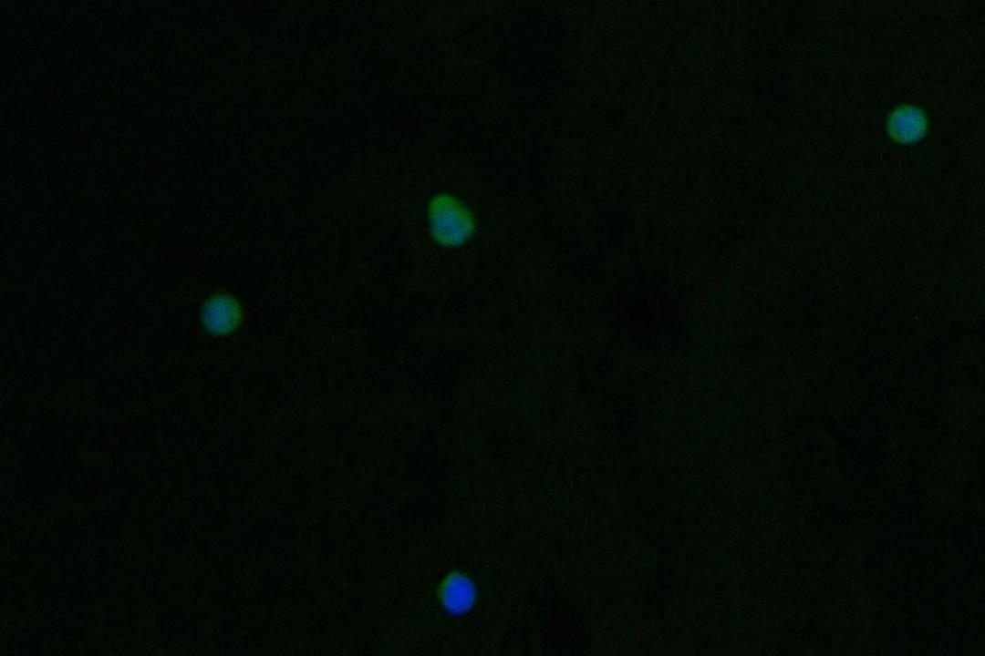 Immunofluorescence staining of Jurkat cell with CSB-RA789332A0HU at 1:50, counter-stained with DAPI. The cells were fixed in 4% formaldehyde and blocked in 10% normal Goat Serum. The cells were then incubated with the antibody overnight at 4°C. The secondary antibody was Alexa Fluor 562-congugated AffiniPure Goat Anti-Rabbit IgG(H+L).