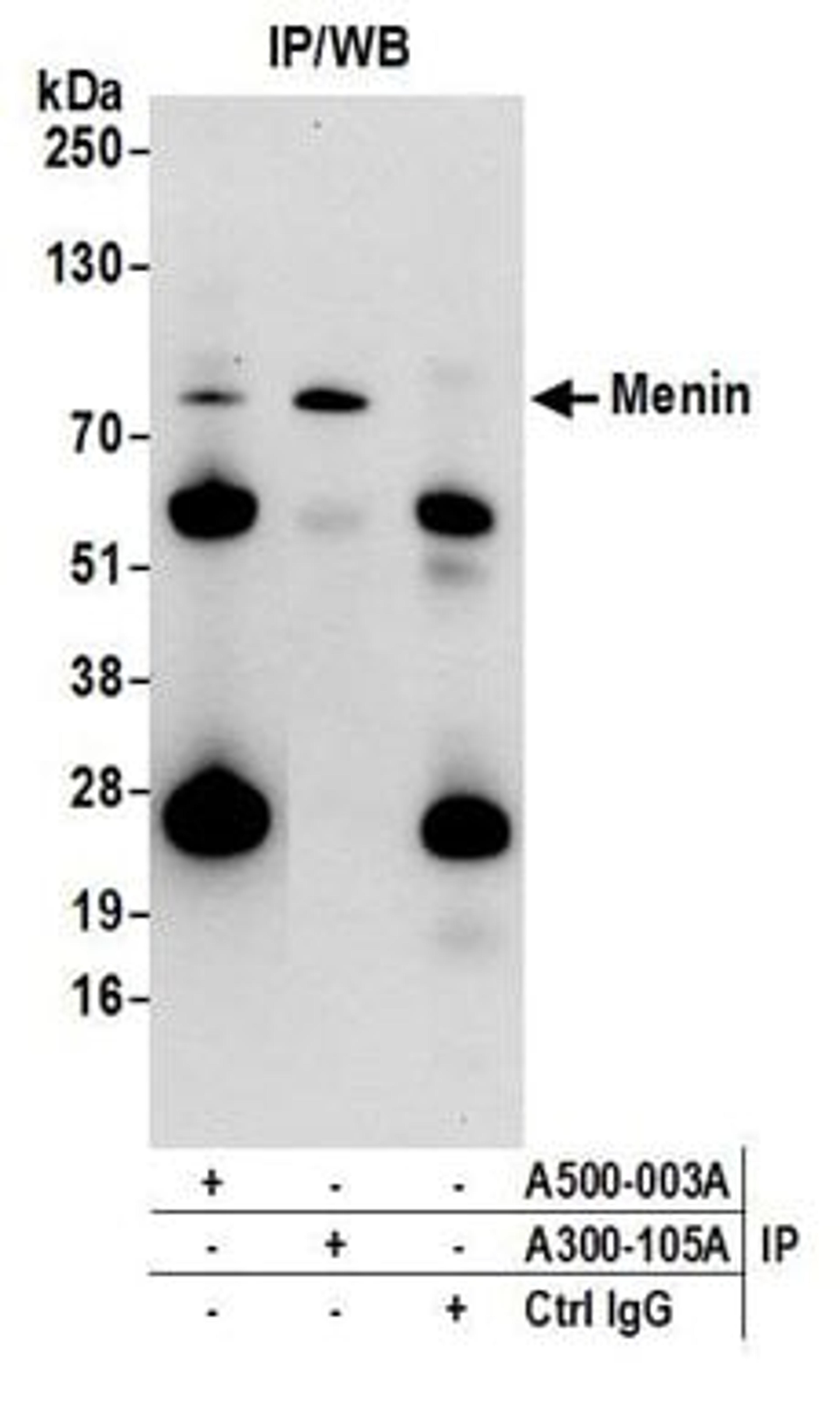 Detection of human Menin by western blot of immunoprecipitates.