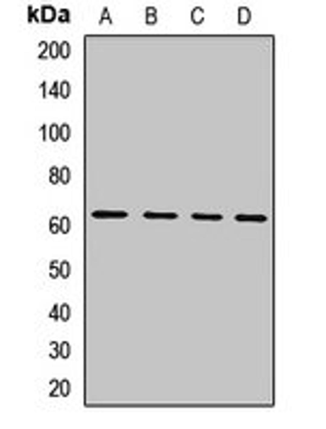 Western blot analysis of HepG2 (Lane1), SKOV3 (Lane2), mouse testis (Lane3), rat testis (Lane4) whole cell lysates using IL4I1 antibody