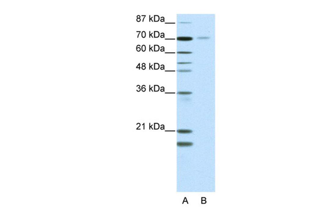 Antibody used in WB on Human HCT15 at 2.5 ug/ml.