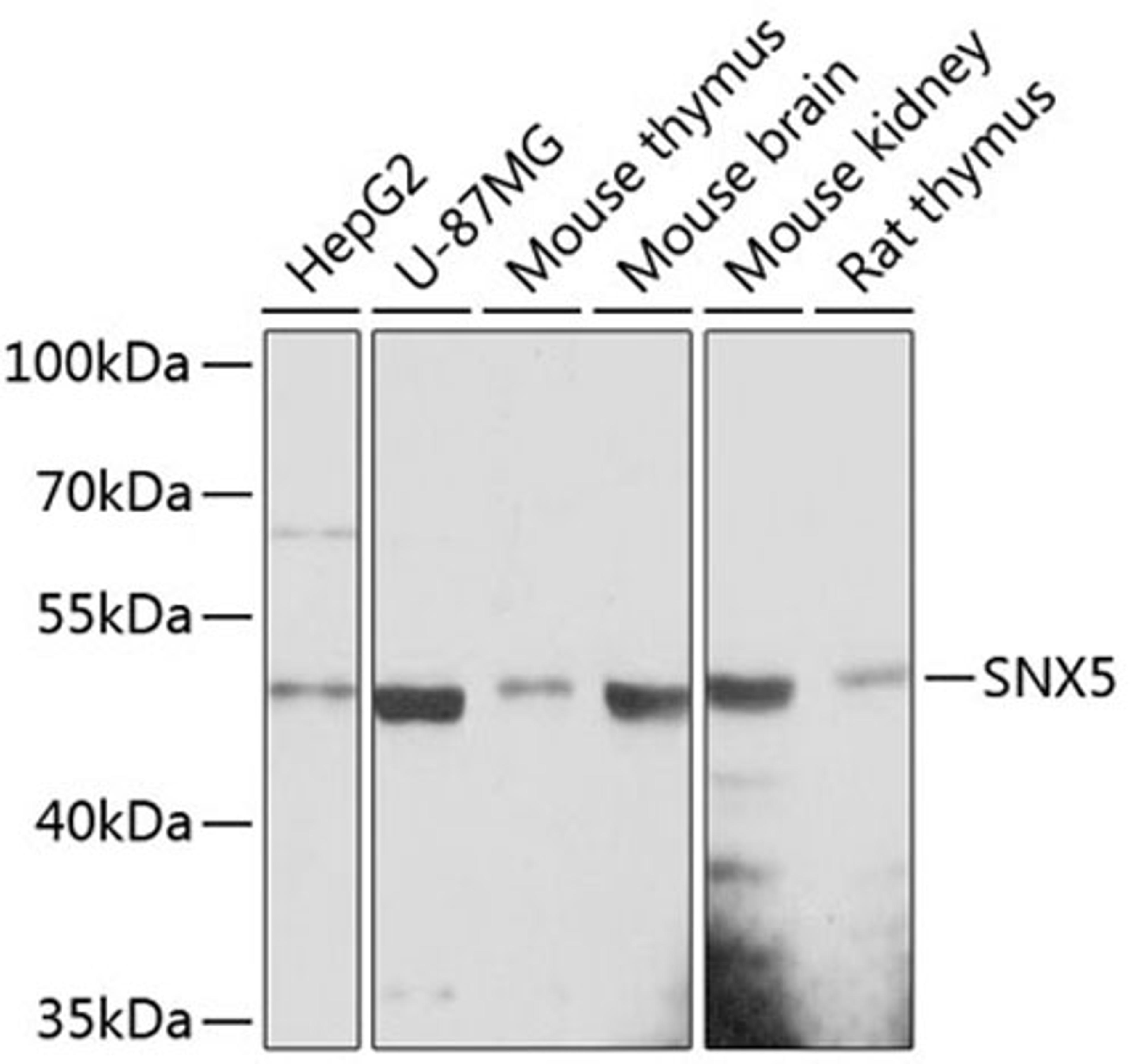 Western blot - SNX5 antibody (A13160)