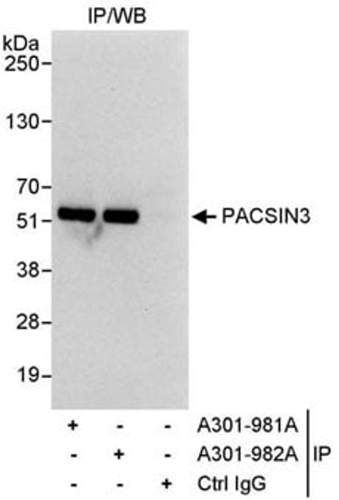 Detection of human PACSIN3 by western blot of immunoprecipitates.