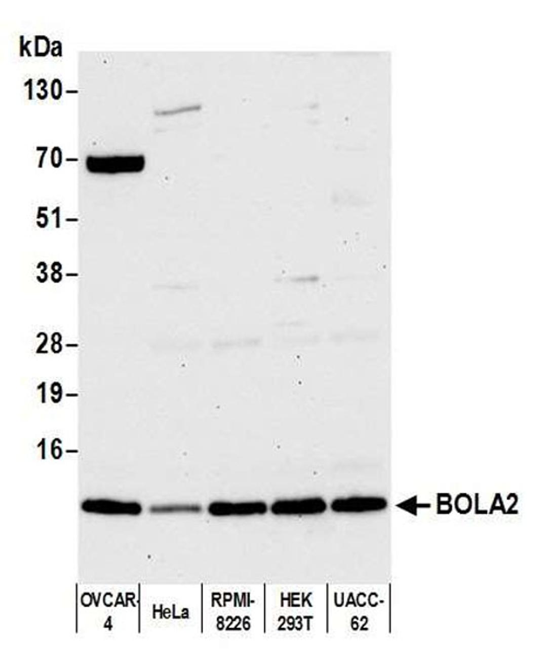 Detection of human BOLA2 by WB.