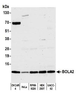 Detection of human BOLA2 by WB.