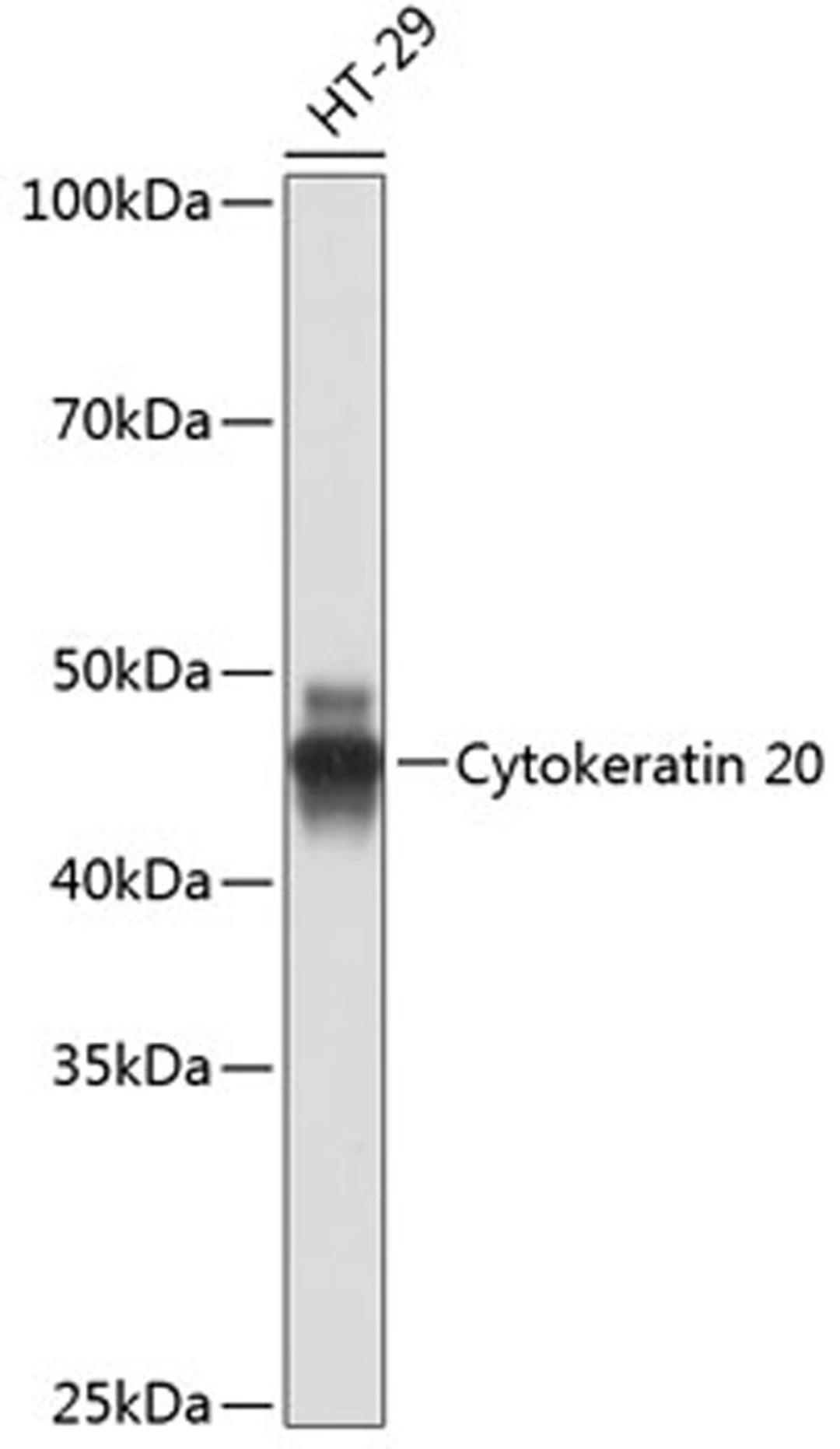 Western blot - Cytokeratin 20 antibody (A19041)